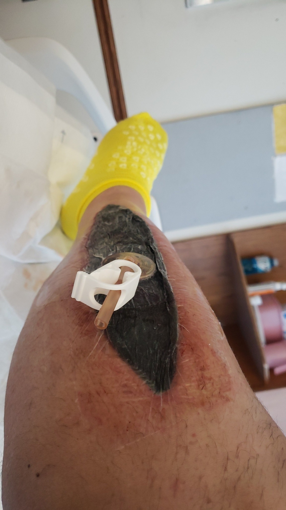 Help Milo Heal: Support His Recovery Journey campaign photo, 2 of 6