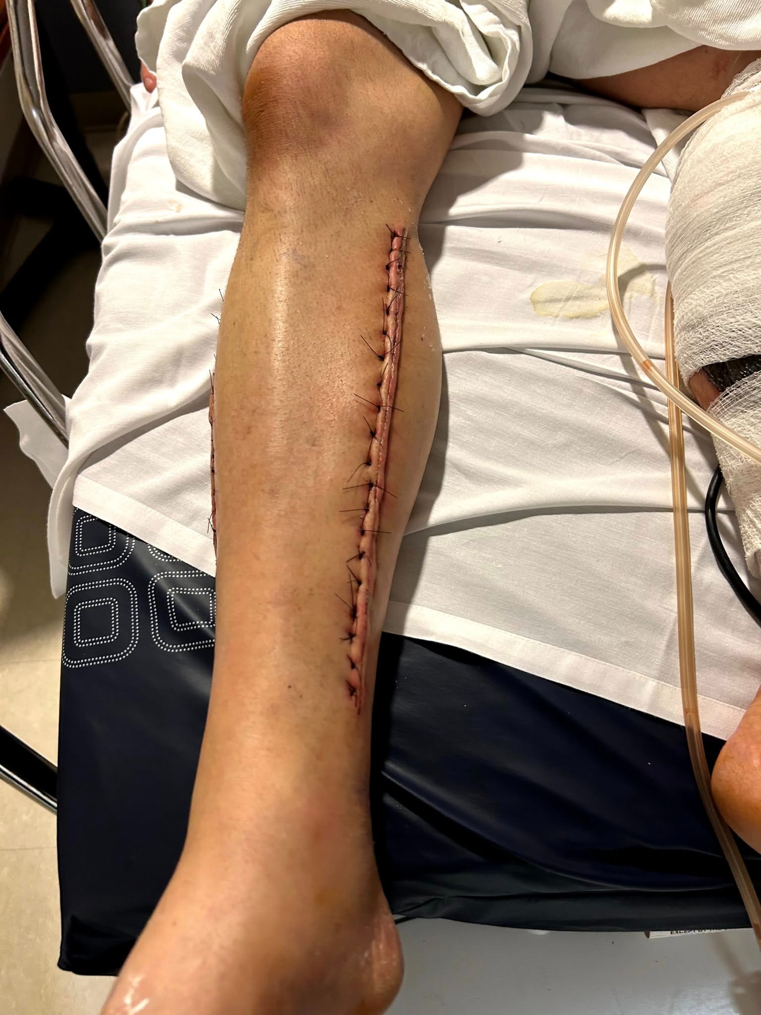 Help Milo Heal: Support His Recovery Journey campaign photo, 4 of 6