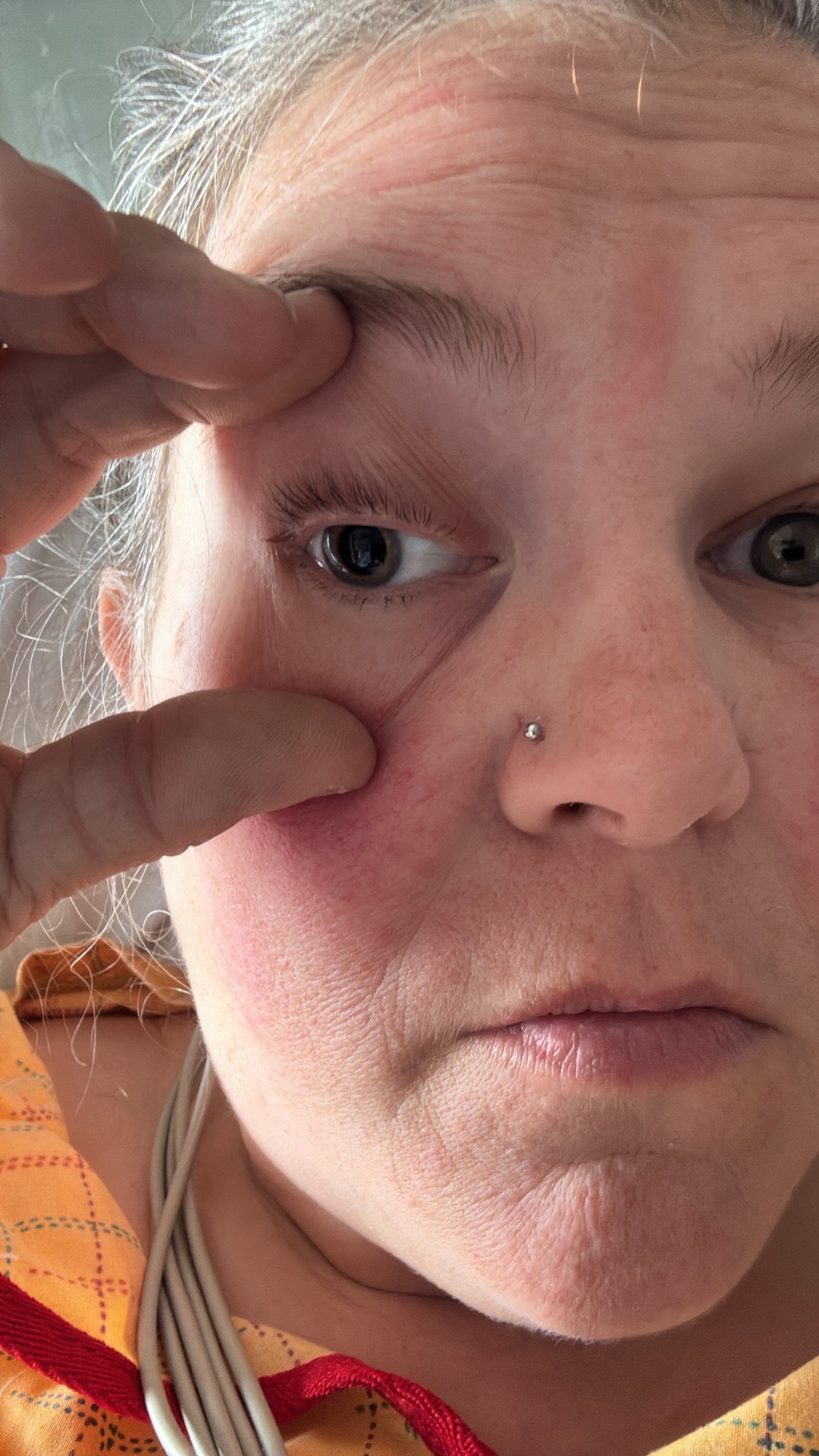 Support Recovery After Brain Aneurysm campaign photo, 6 of 7