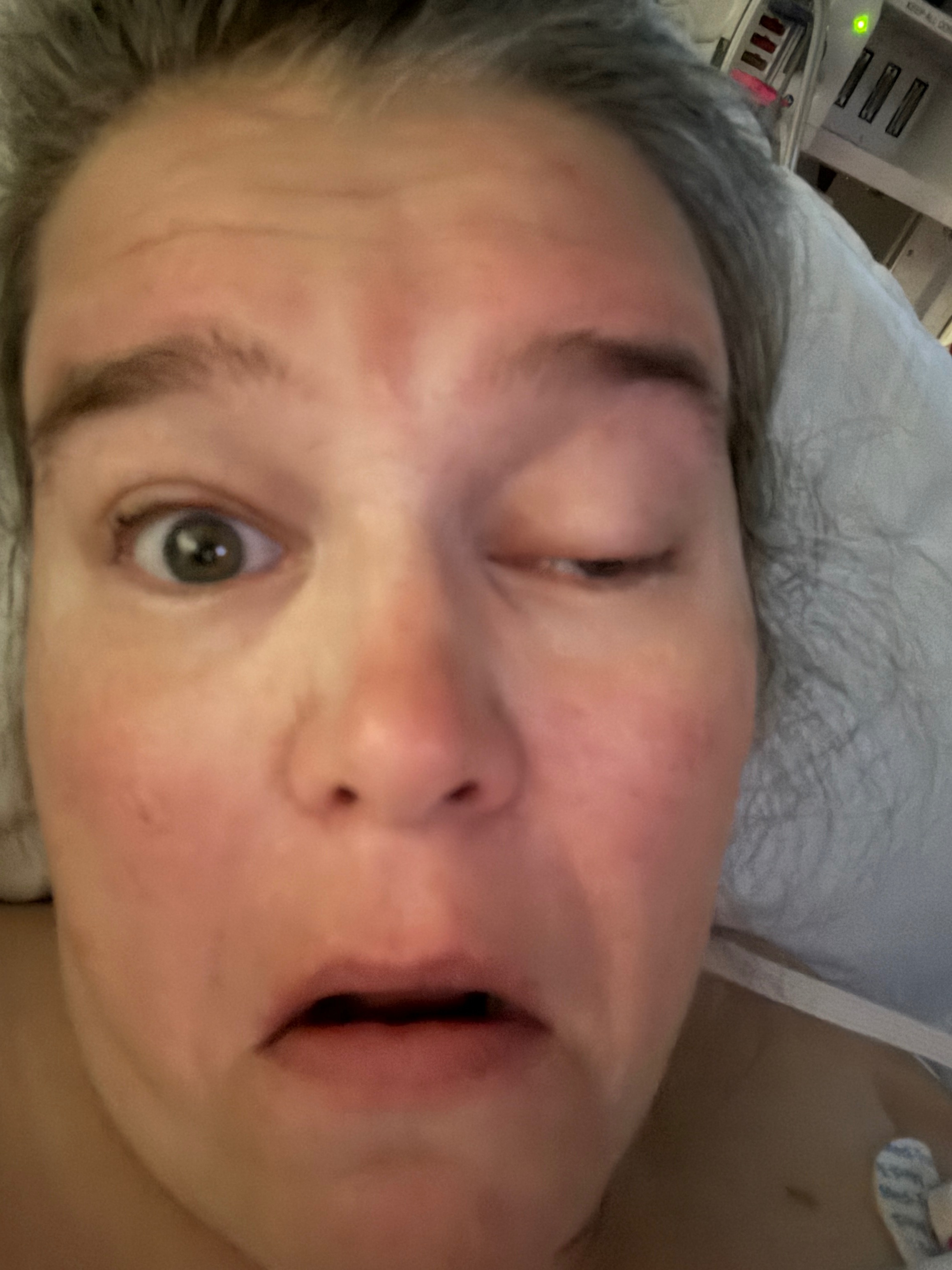 Support Recovery After Brain Aneurysm campaign photo, 4 of 7