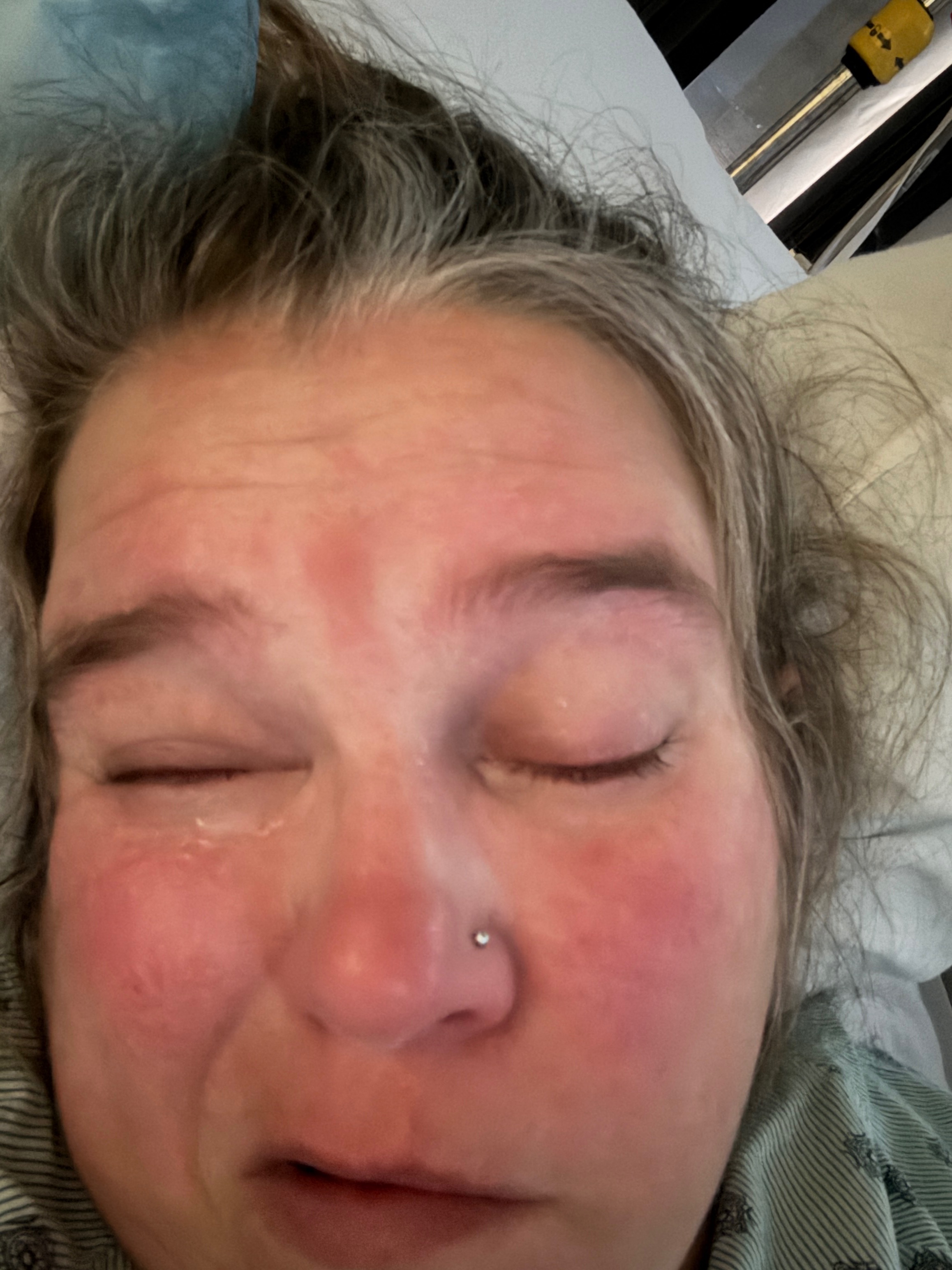 Support Recovery After Brain Aneurysm campaign photo, 2 of 7