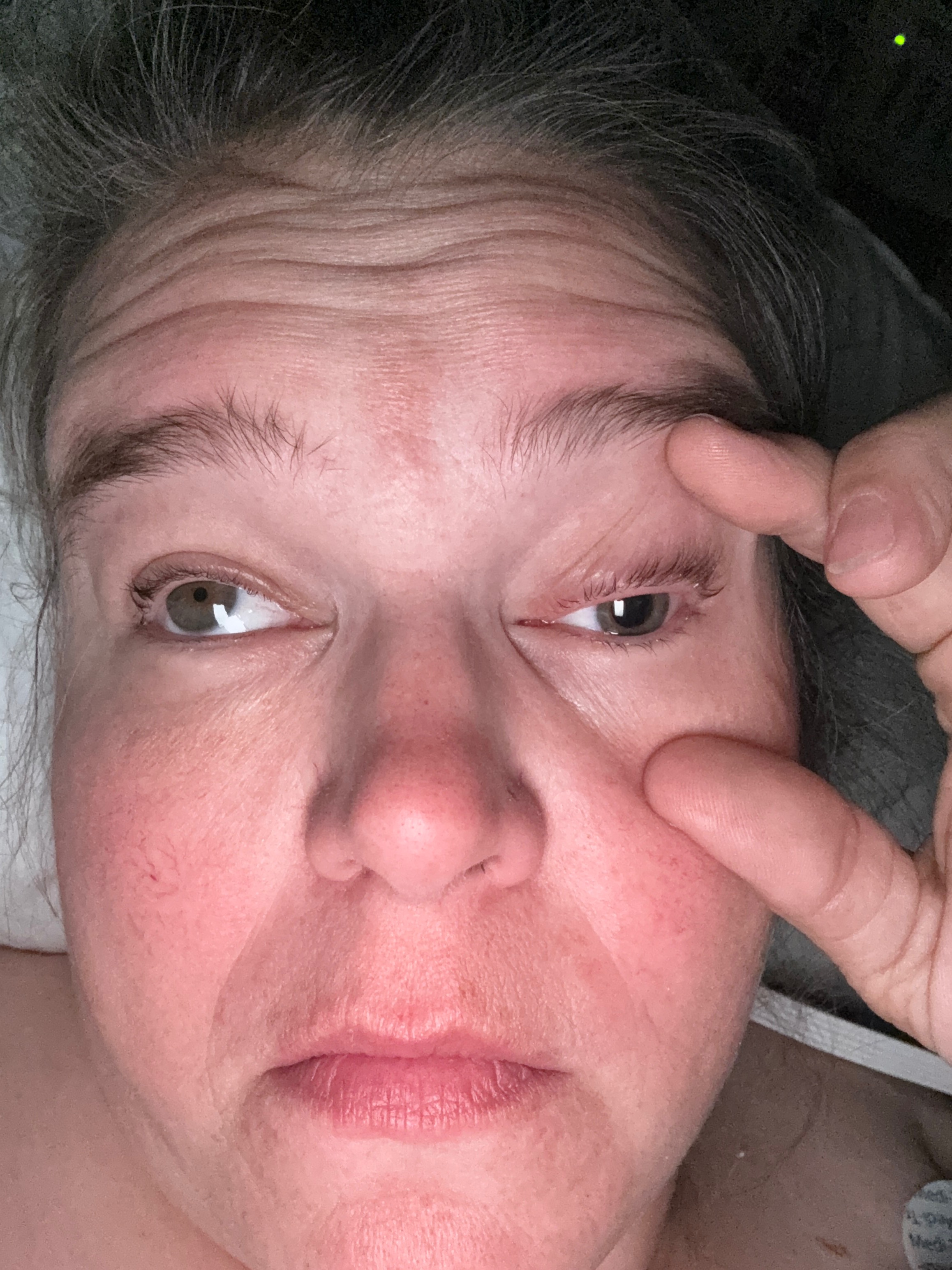 Support Recovery After Brain Aneurysm campaign photo, 5 of 7