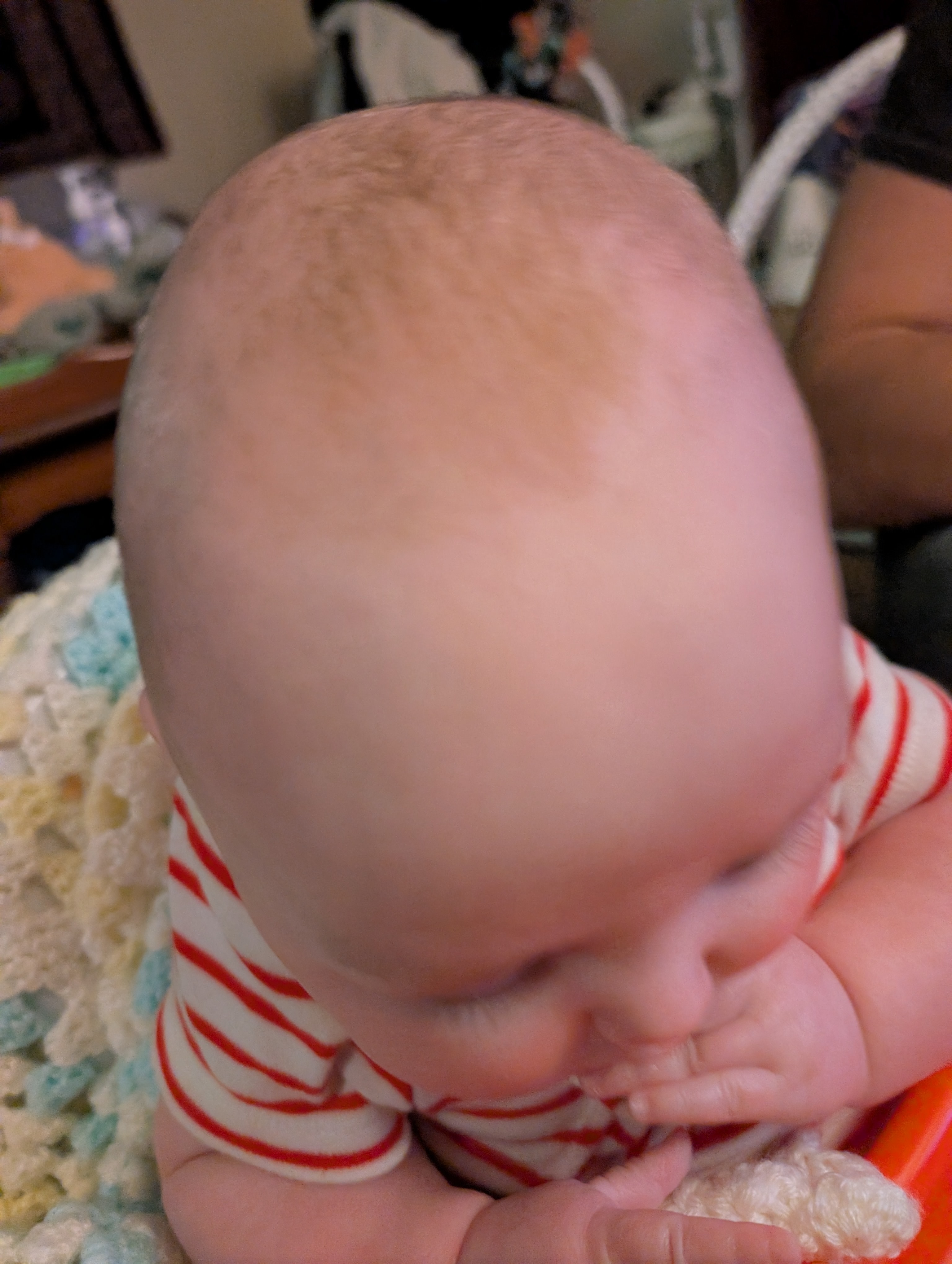 Help Declan Get His Life-Changing Helmet campaign photo, 4 of 5