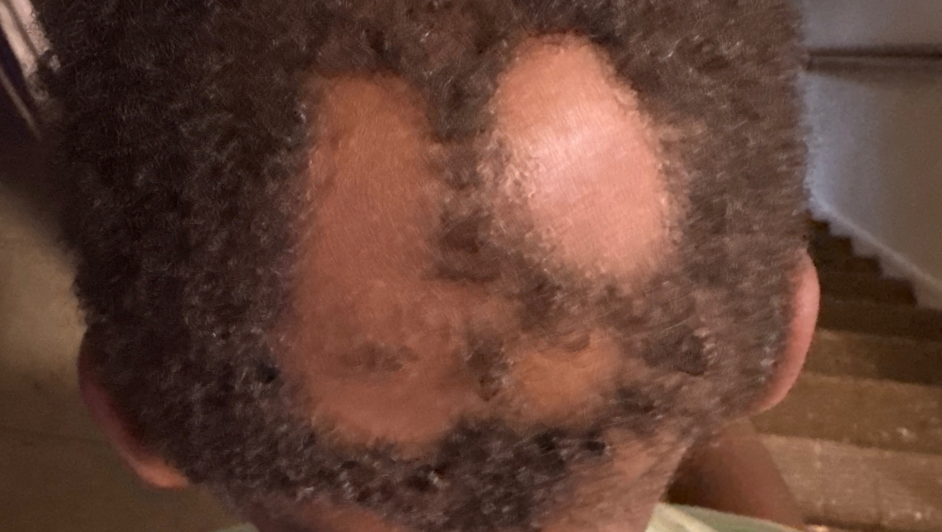 Donate for Damaris Howell's Hair Growth photo