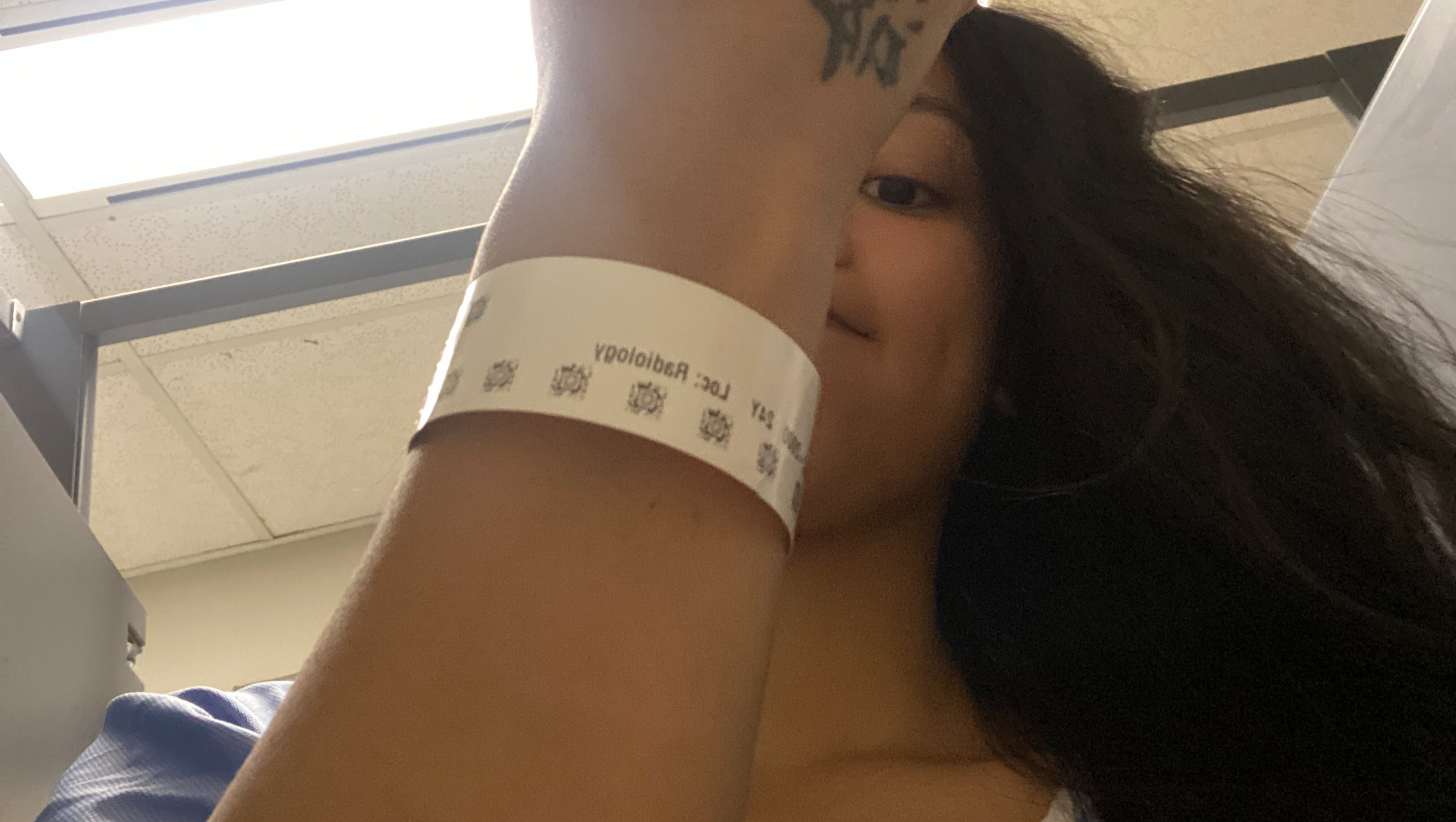 Stomach Cancer in my 20s photo