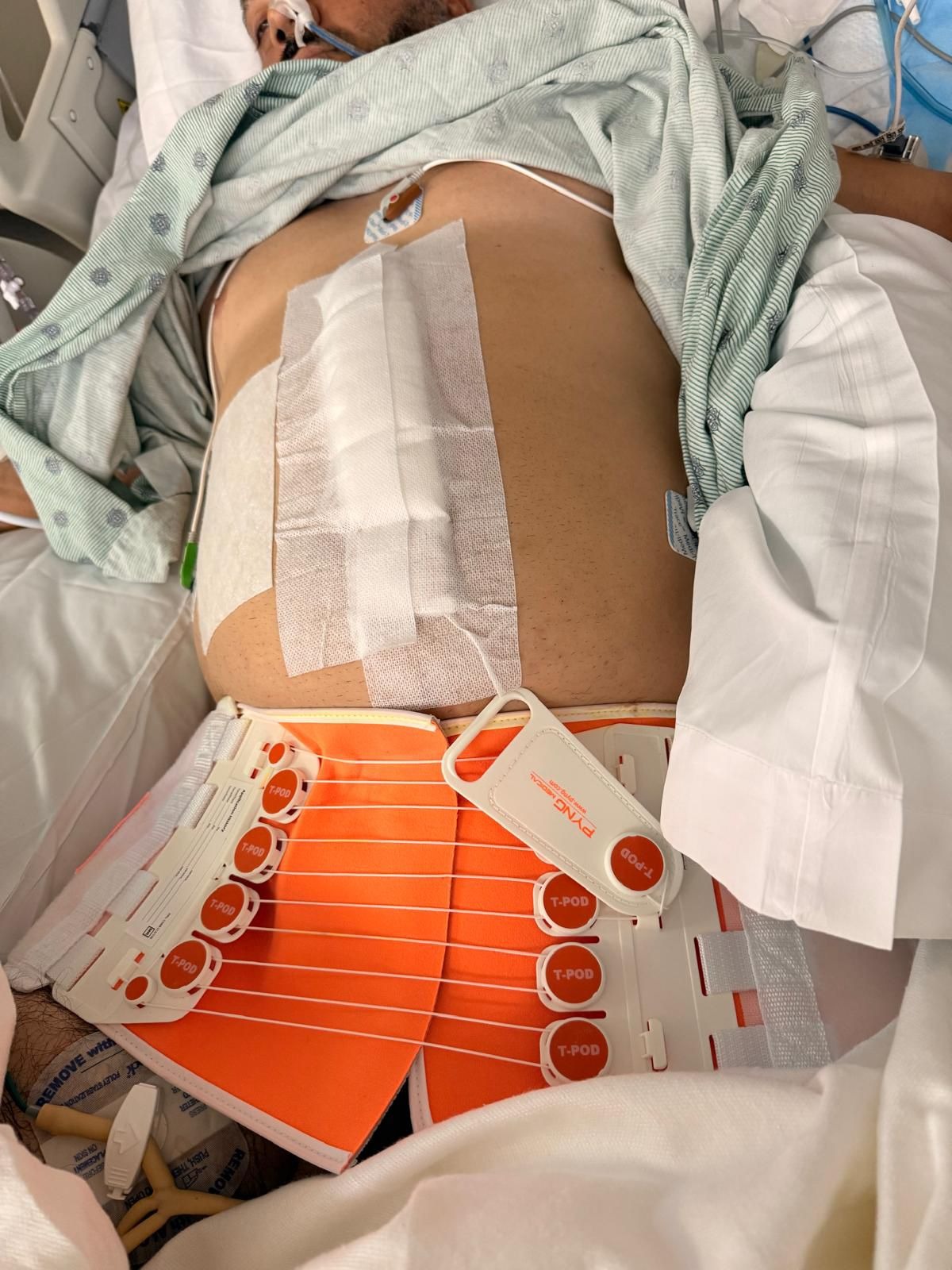 Help Luis Recover After a Devastating Motorcycle Accident campaign photo, 7 of 8