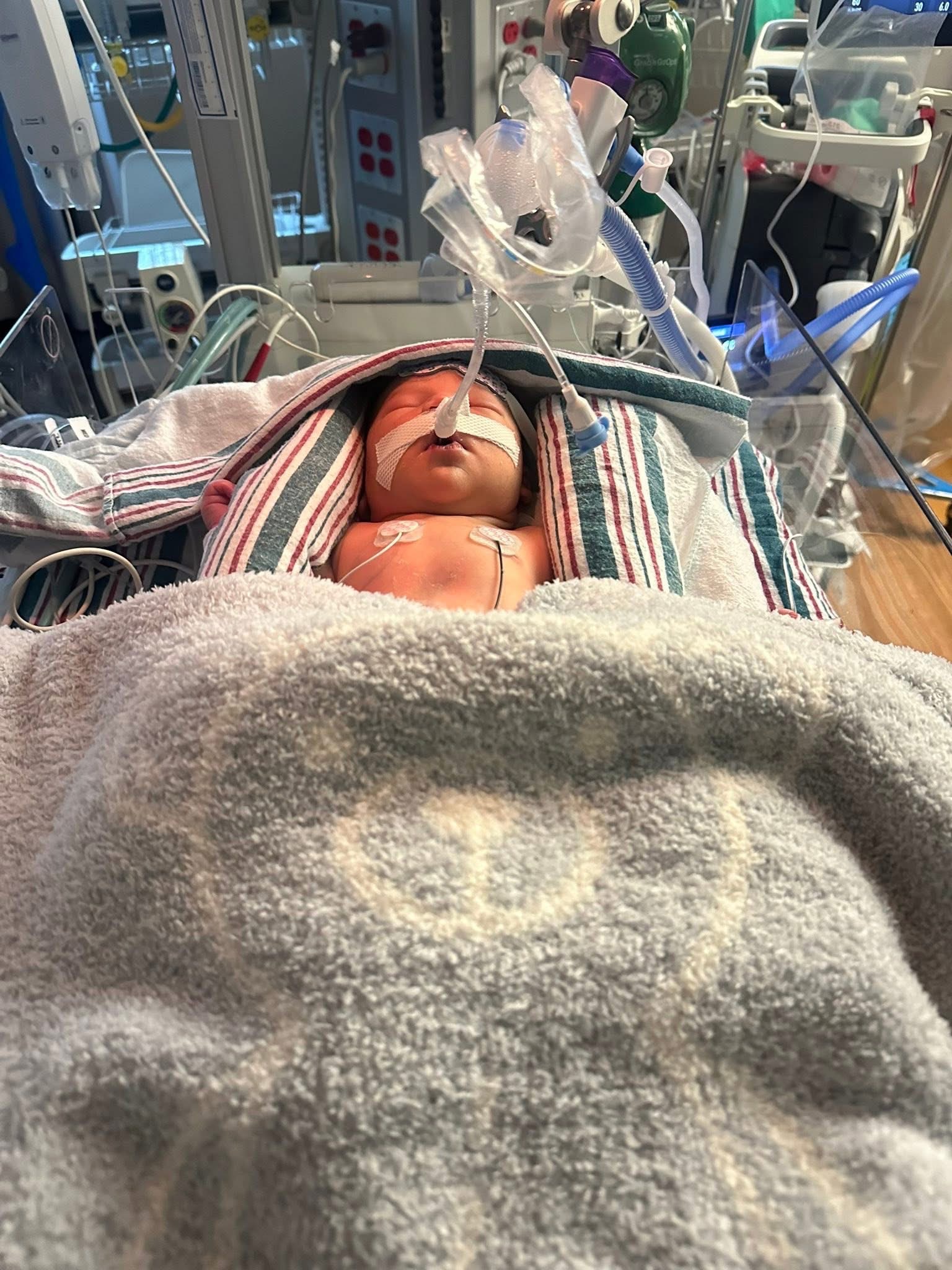 Support Baby Johnny Cruz’s Heart Surgery campaign photo, 2 of 6