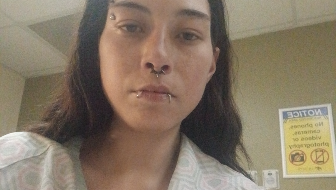 Minor Surgery- Aftercare photo