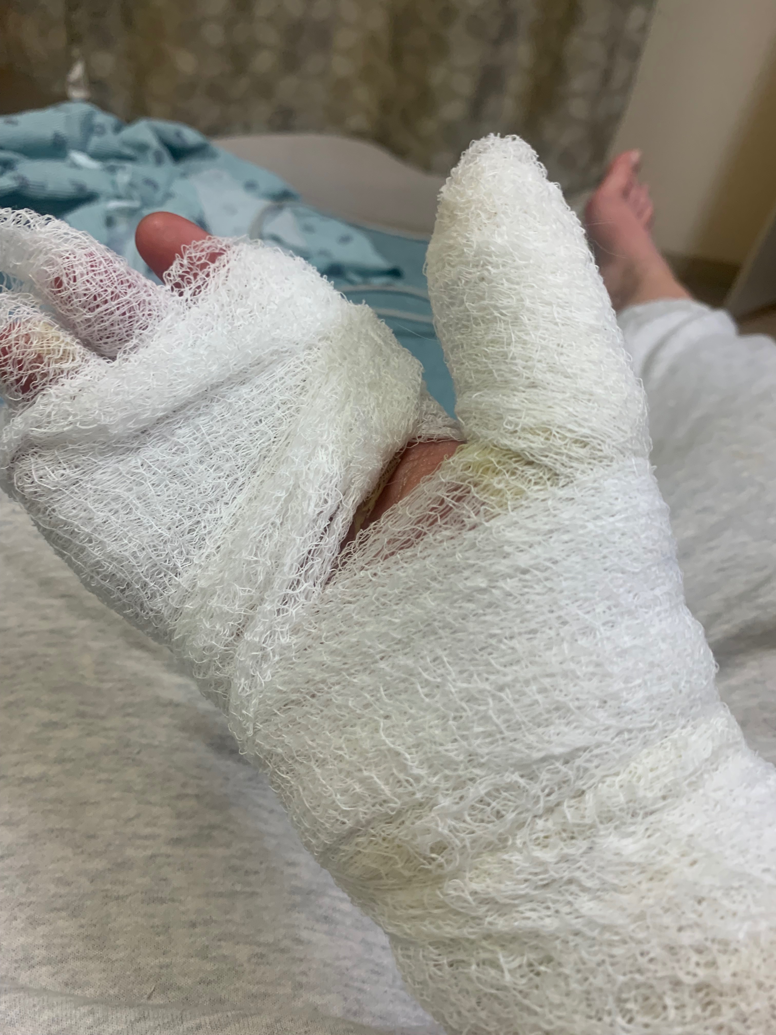 Help Dakota Recover from Burn Injuries, & Hospitalized Mom campaign photo, 2 of 6