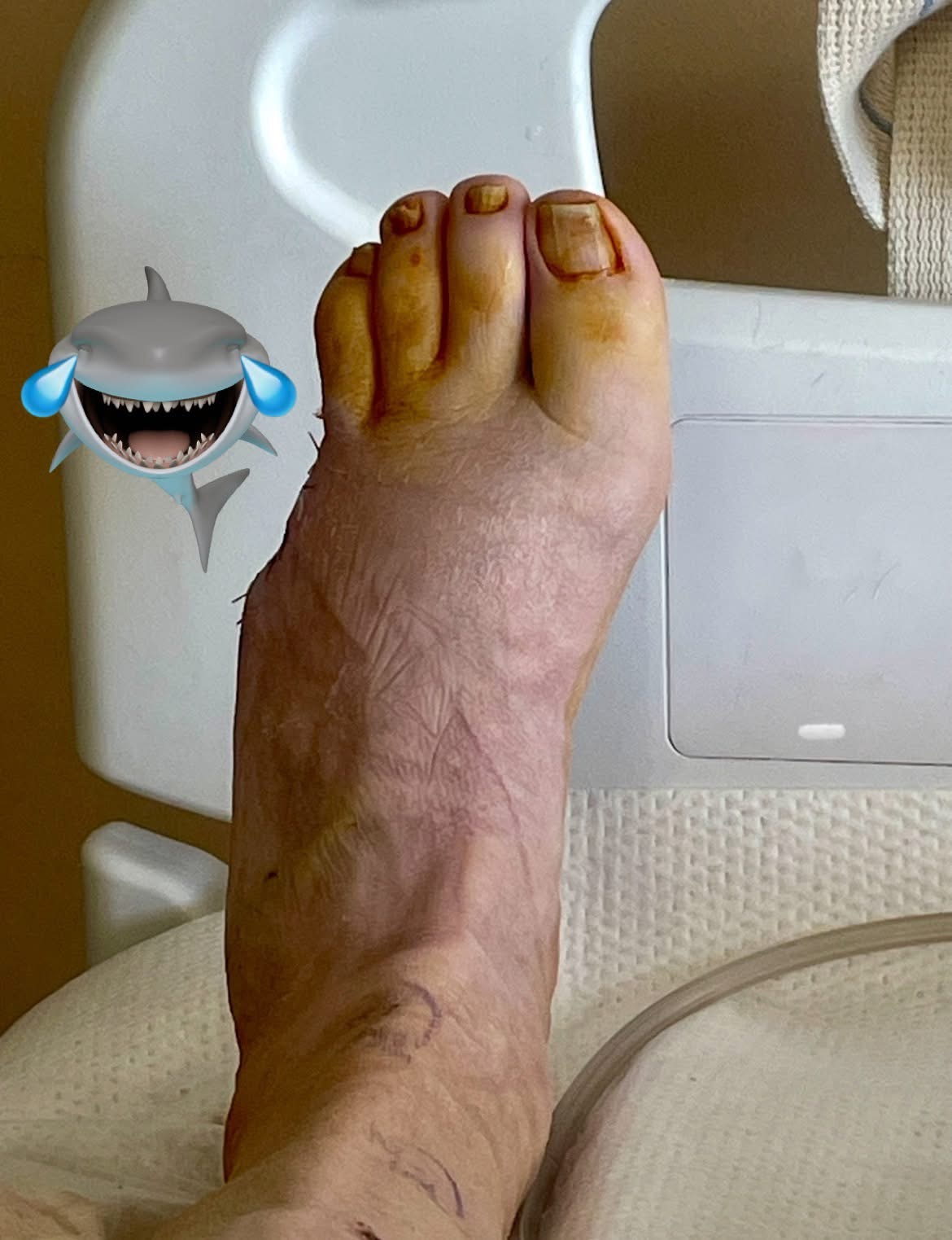 Support Chris's Recovery from Foot Injuries campaign photo, 4 of 6