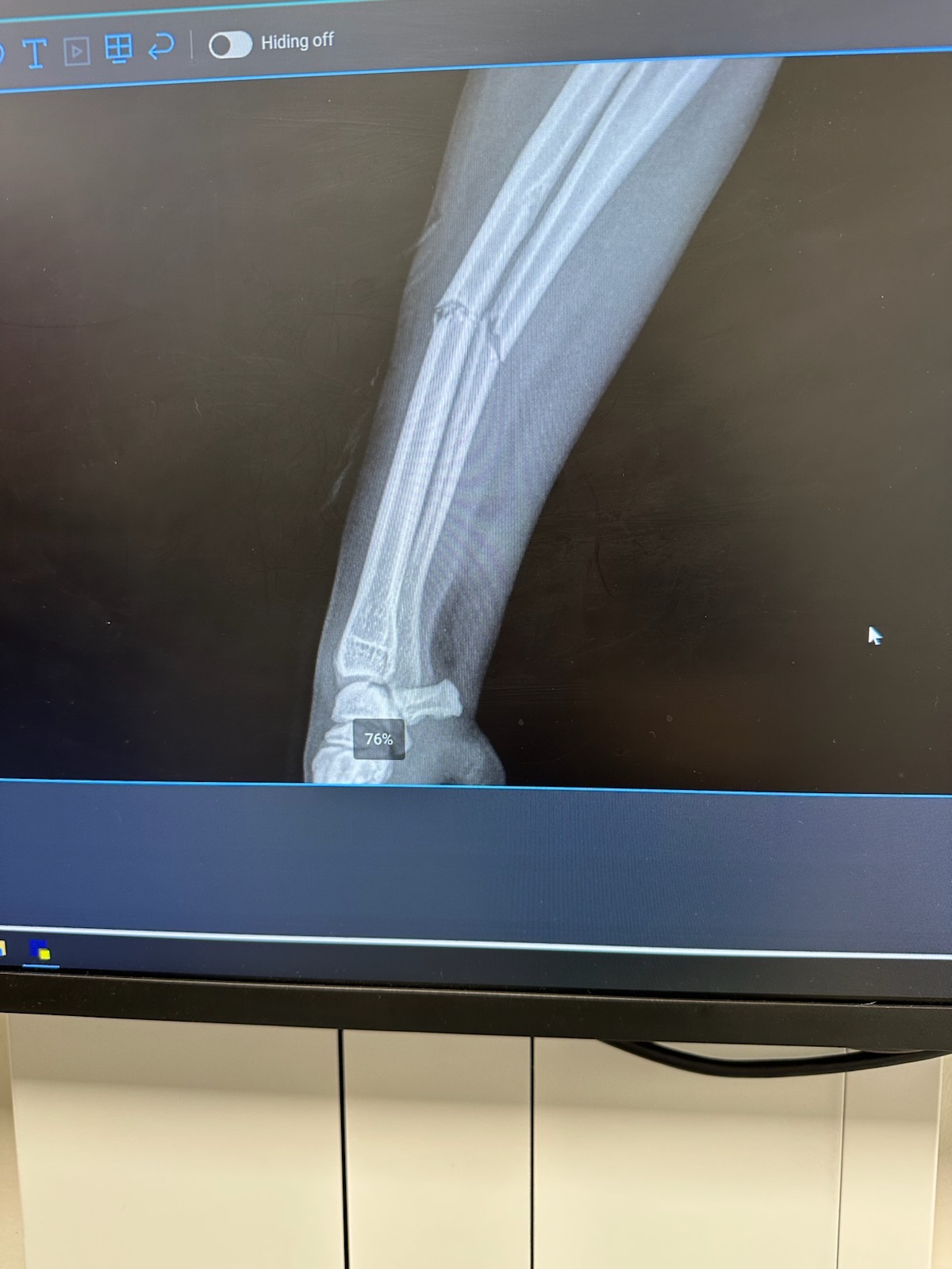 Help Lucy Heal After Her Accident campaign photo, 2 of 8
