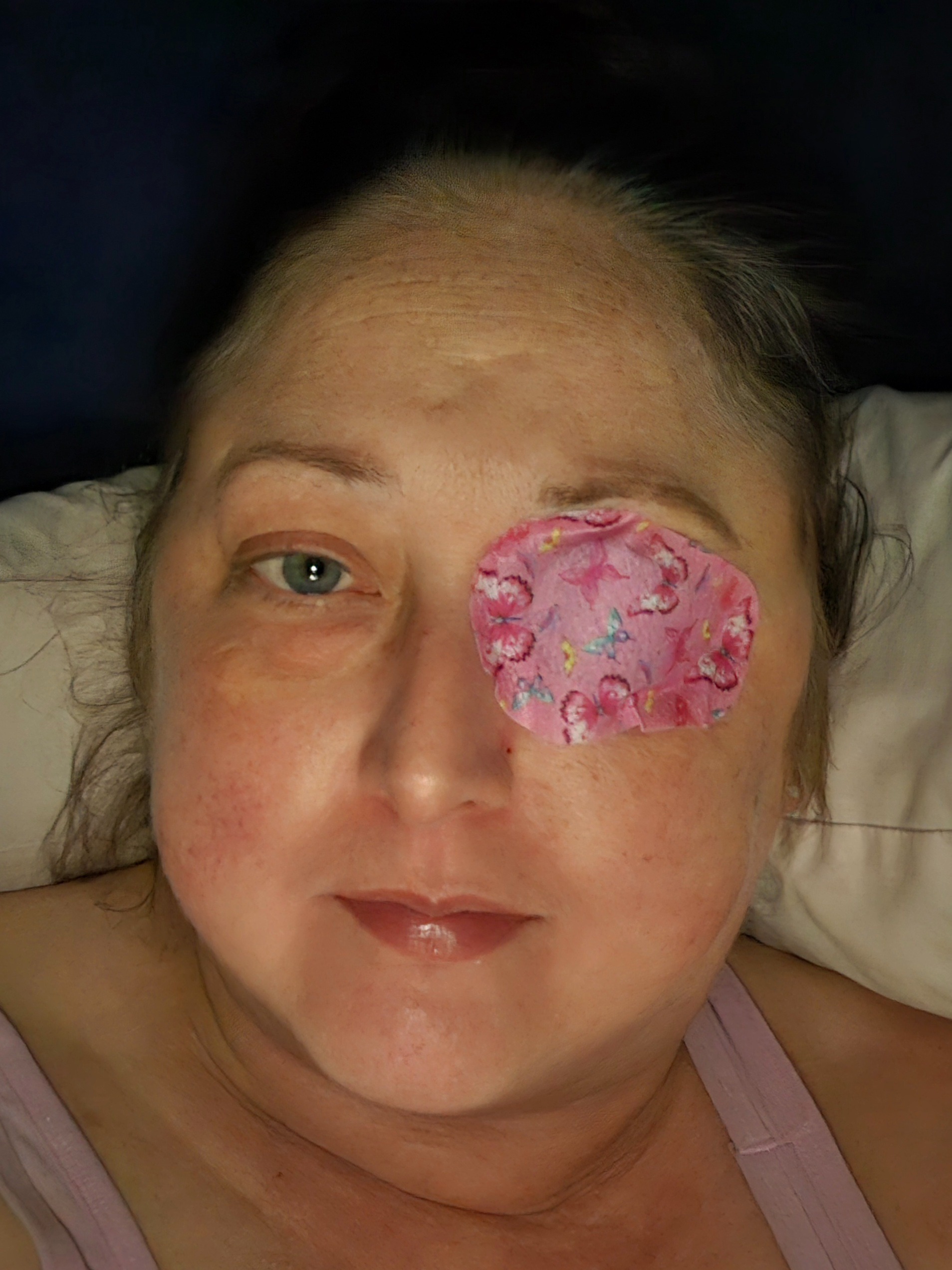 Help Cheri (Biggs) Harper Battle Cushings Syndrome campaign photo, 2 of 4