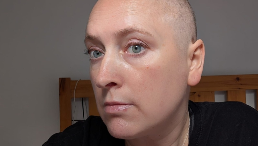 Please help Aiga in battle with cancer photo