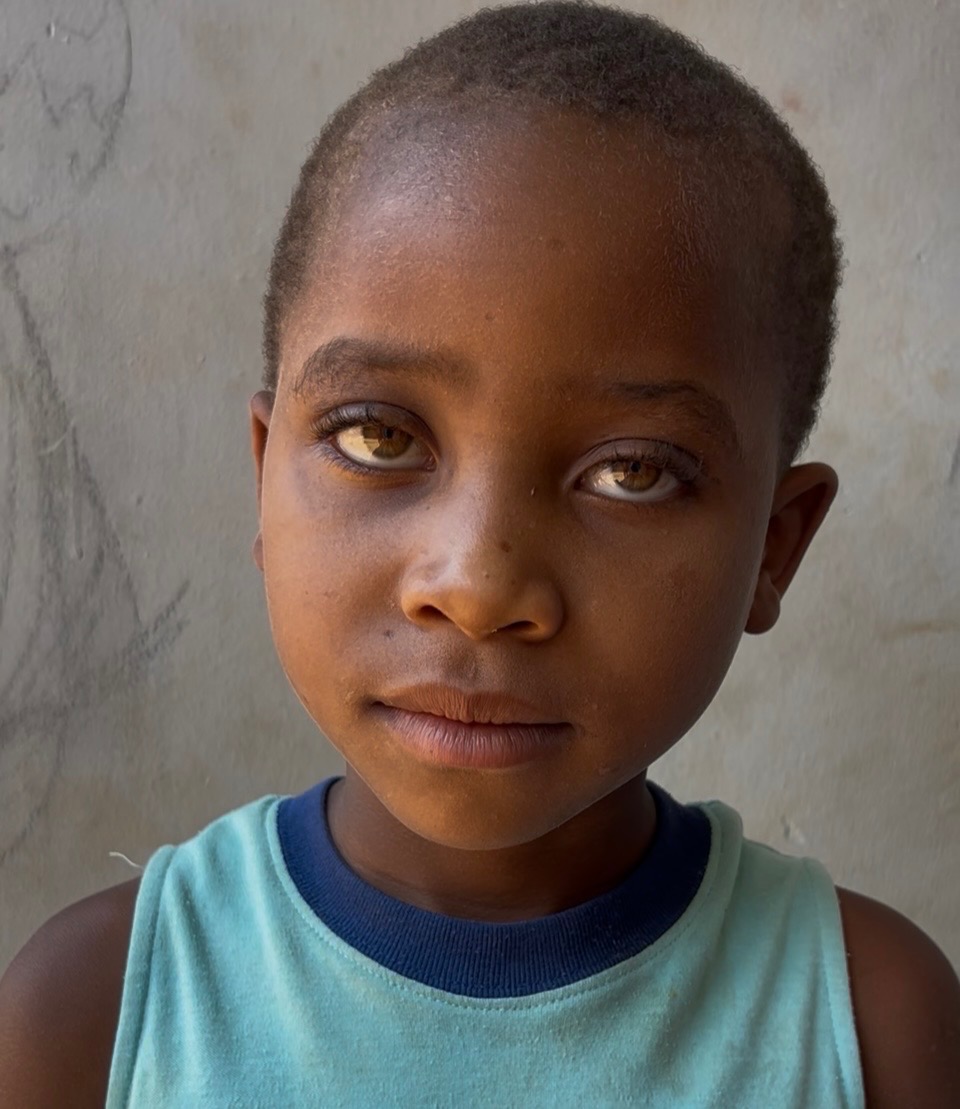 Down-syndrom Kids in Malawi campaign photo, 4 of 5