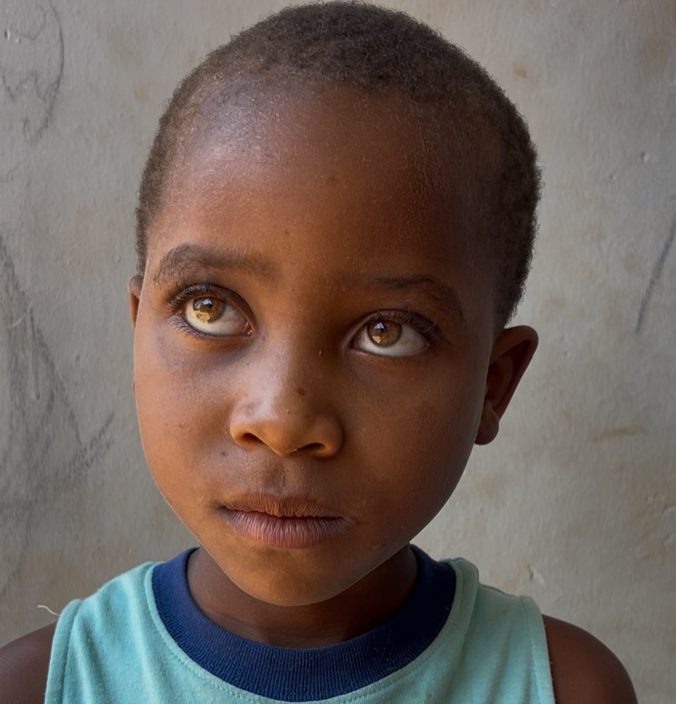 Down-syndrom Kids in Malawi campaign photo, 2 of 5