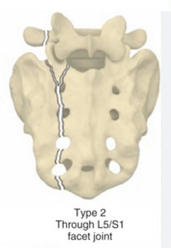 Brad has a Broken Back & Spinal Injury campaign photo, 6 of 7