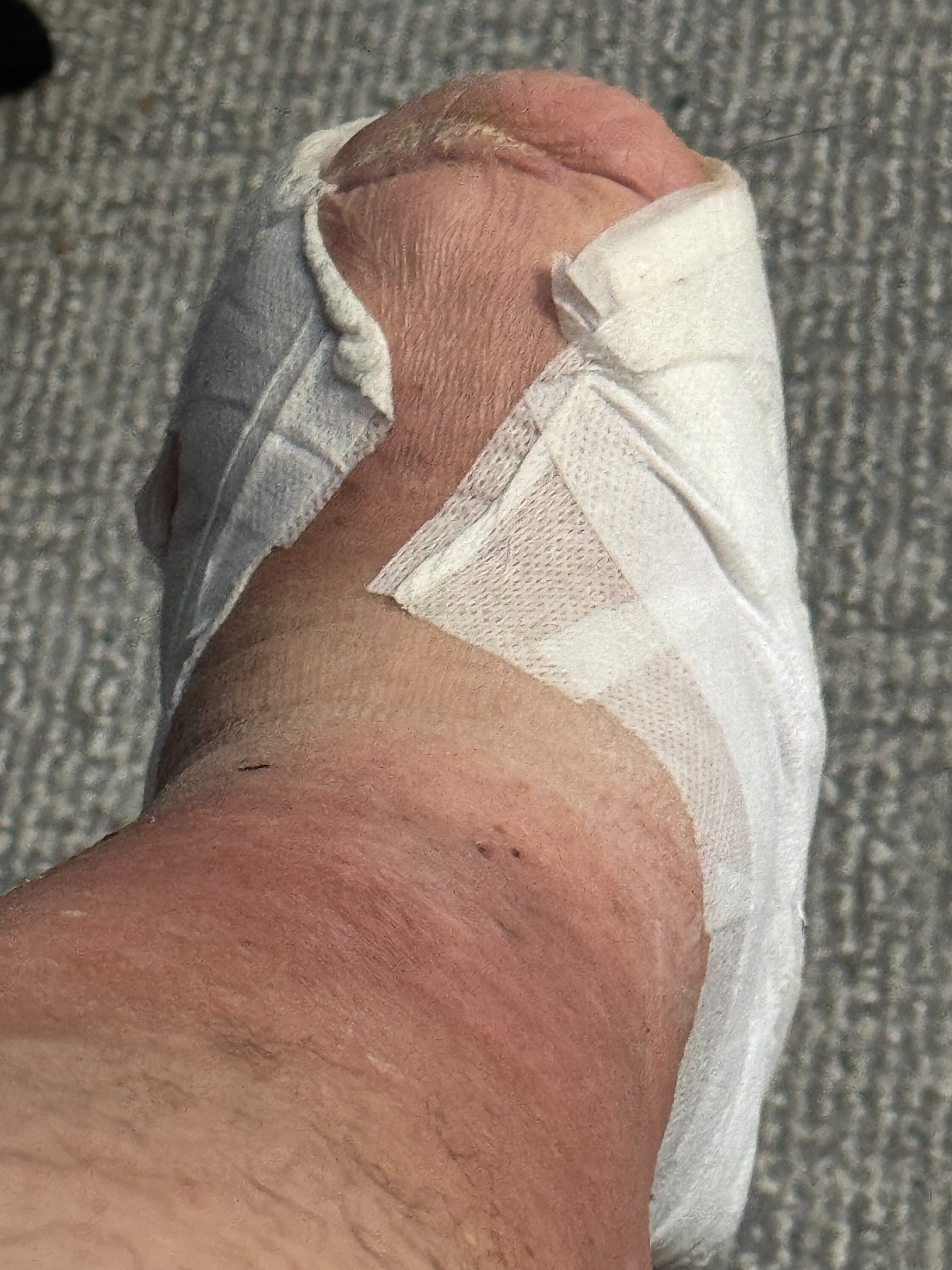 Help Pastor Michael Stay Mobile During Recovery campaign photo, 6 of 7