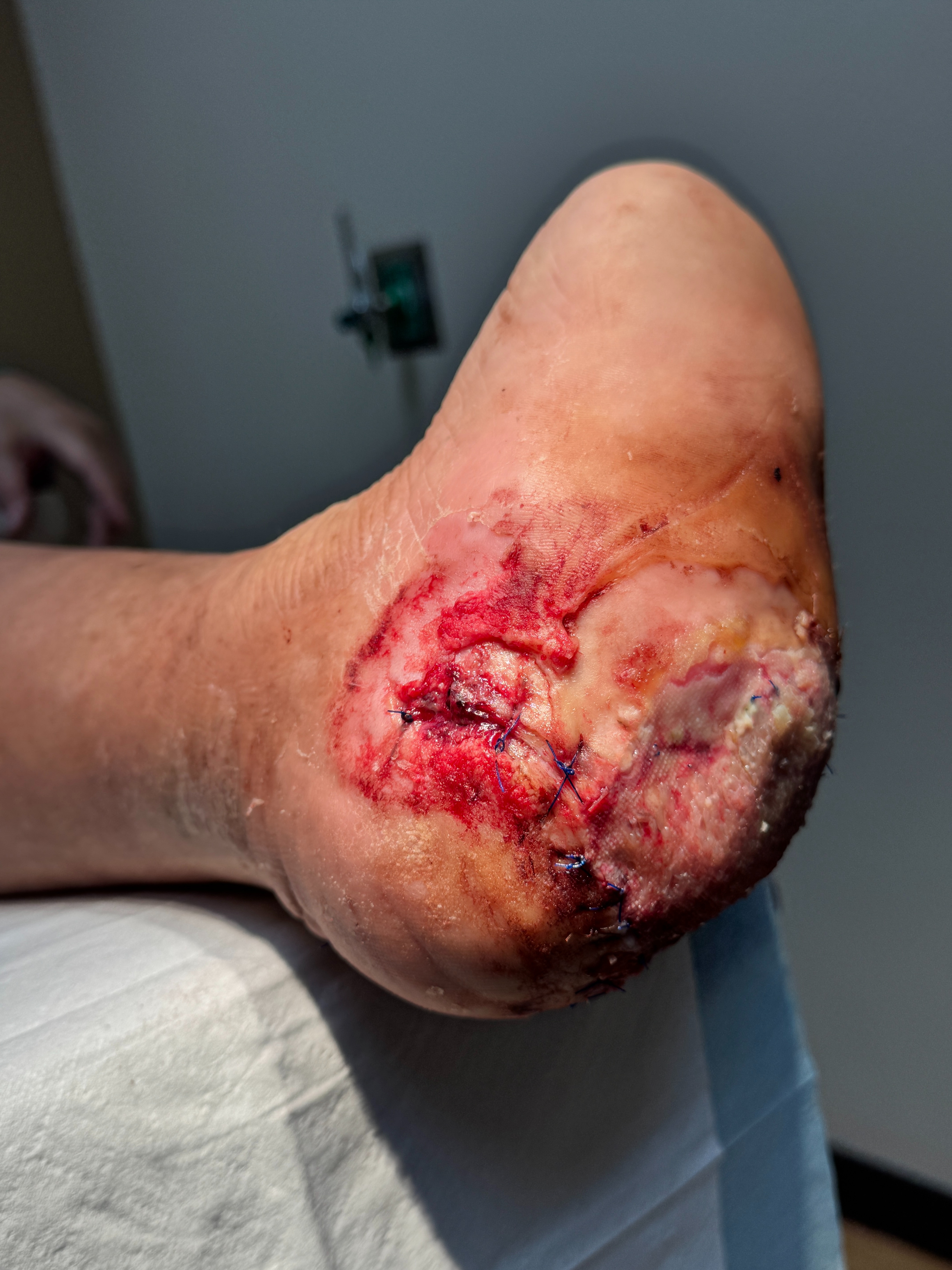 Help Pastor Michael Stay Mobile During Recovery campaign photo, 2 of 7