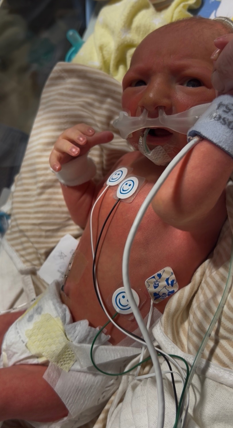 Help for baby Alex and family campaign photo, 5 of 6