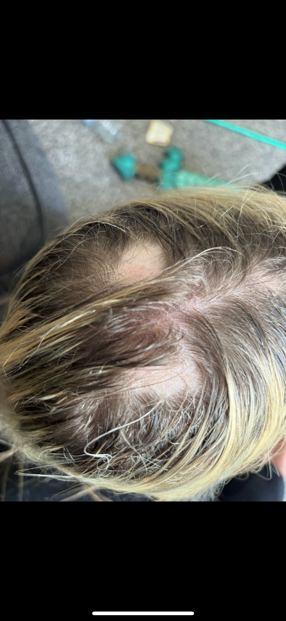 Fundraiser by zoe smith : My 13yr old has been diagnosed with