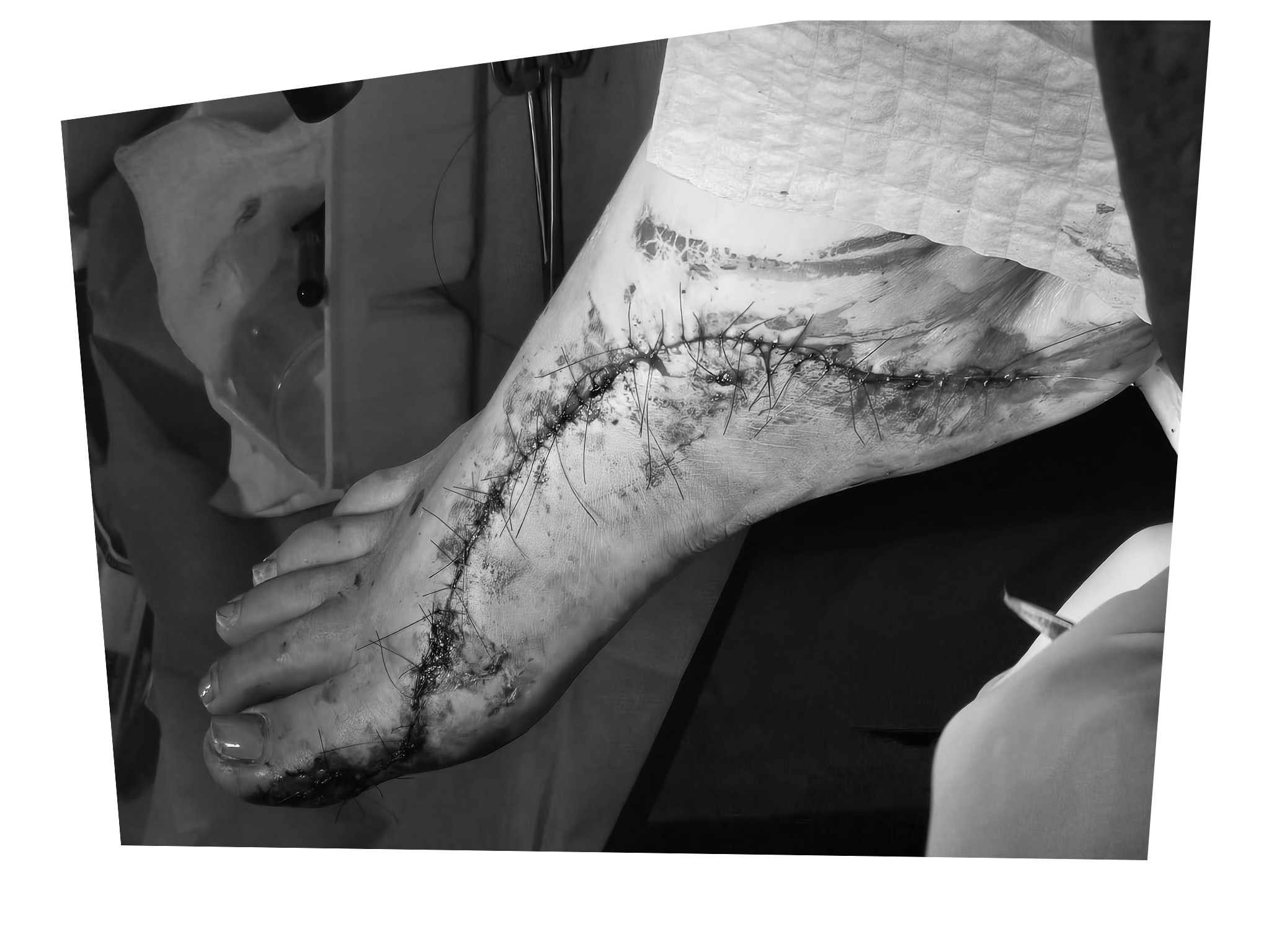 Support Adriana's Recovery After Car Accident campaign photo, 5 of 6
