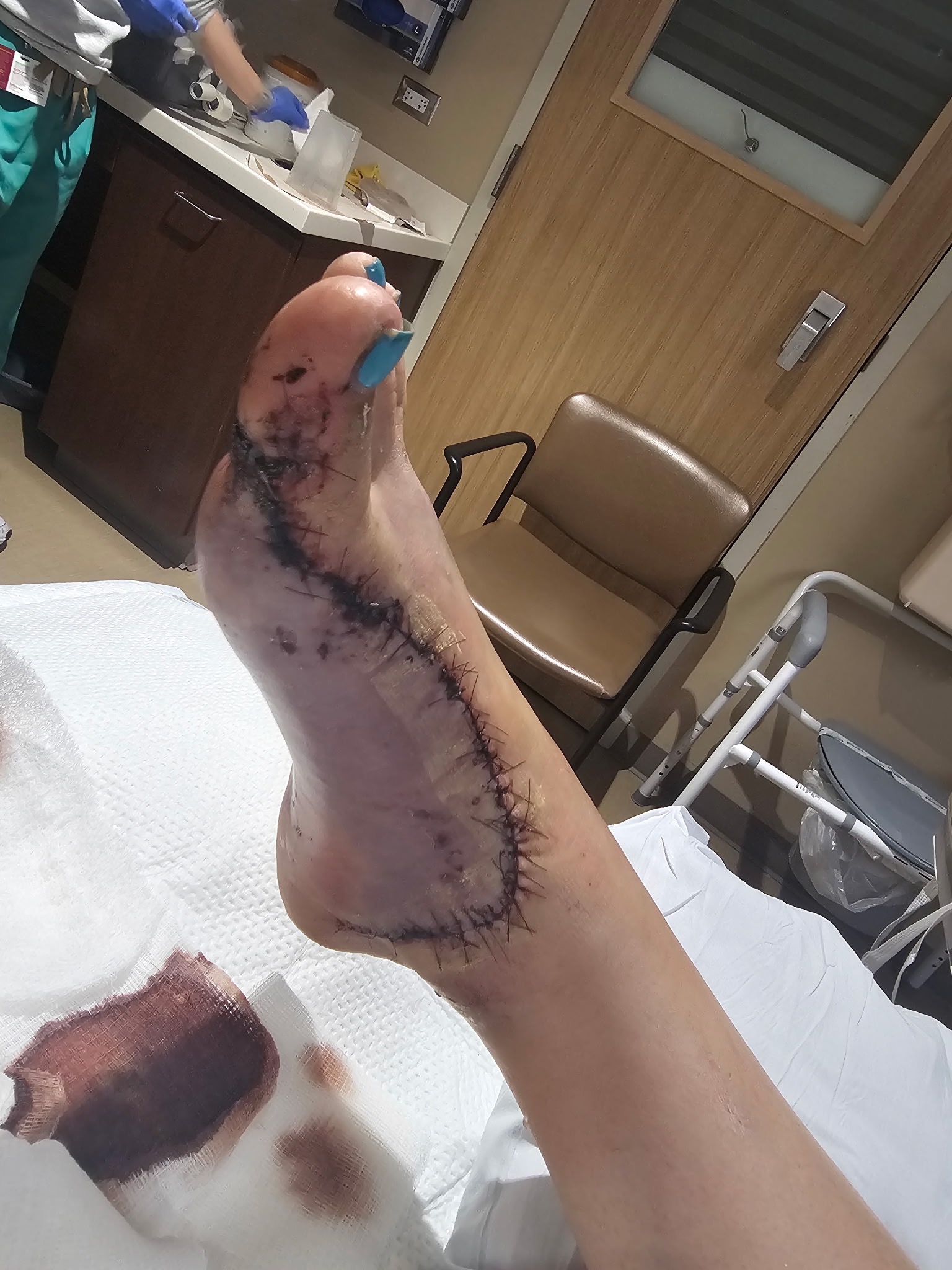 Support Adriana's Recovery After Car Accident campaign photo, 2 of 6