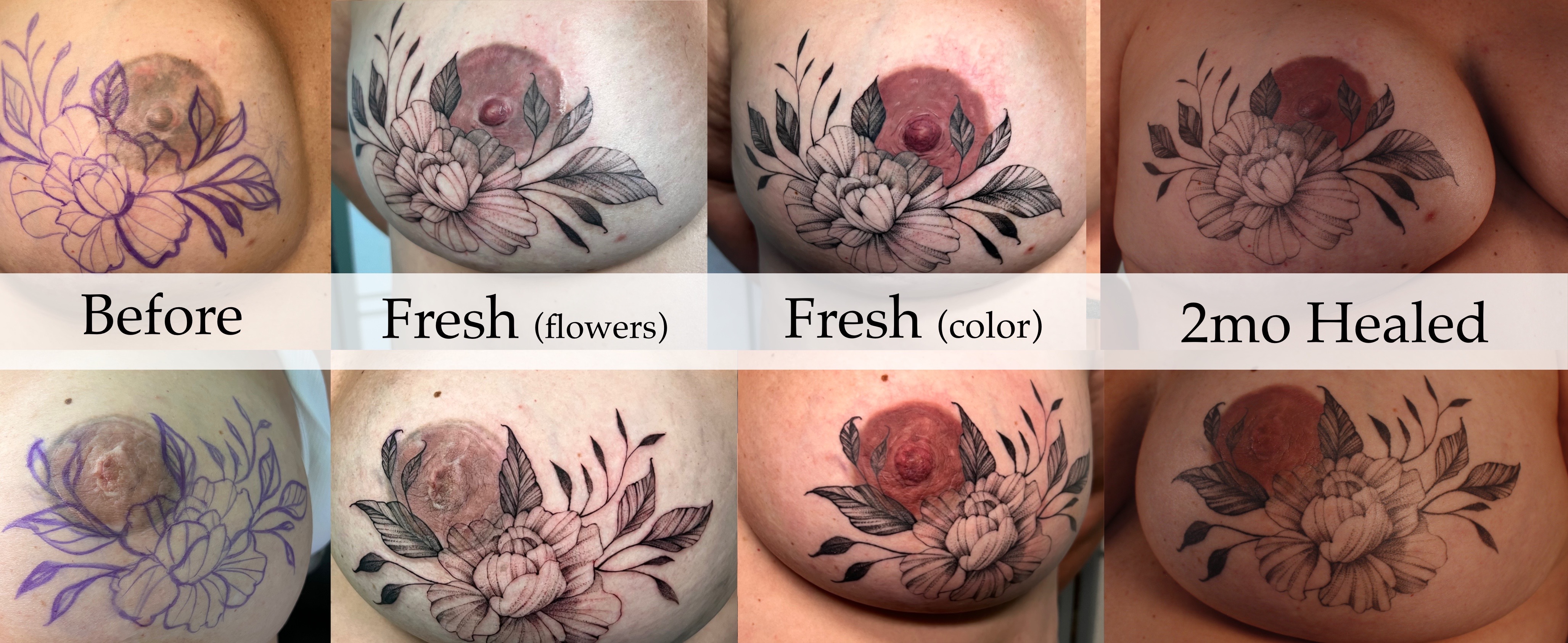 Support Breast Cancer Survivors with the Art of Tattooing campaign photo, 5 of 7