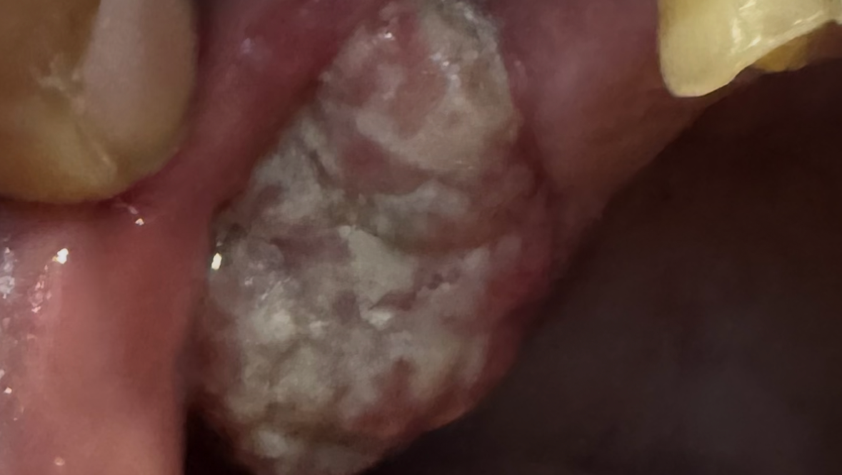 Support Robert Gomes' Battle Against Cancer photo