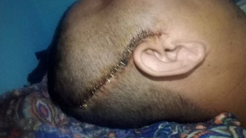 Support Bhim Bahadur Gaha Magar's Recovery