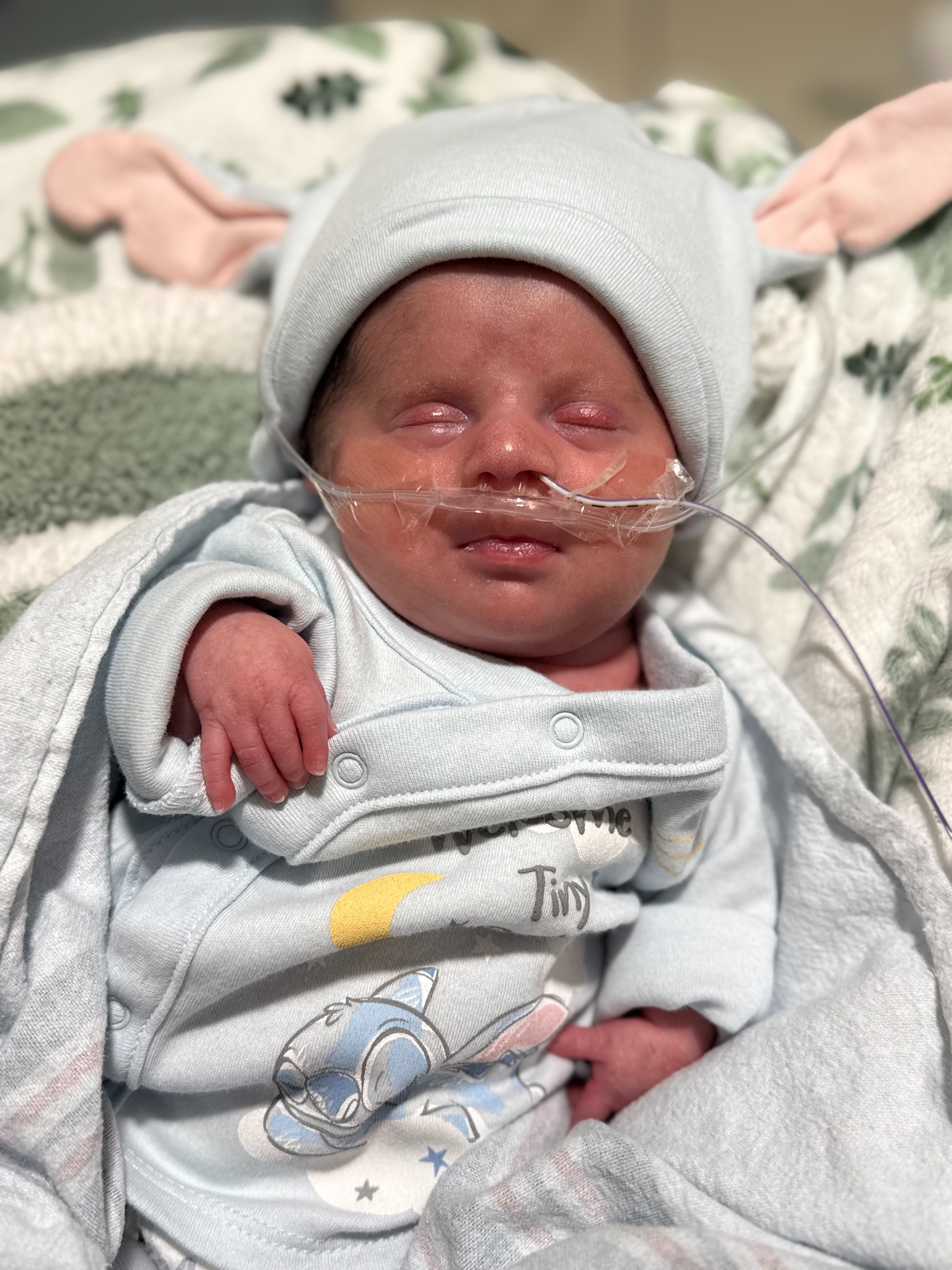 Help Baby Michael Fight His Rare Genetic Condition campaign photo, 7 of 8
