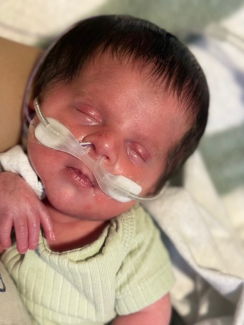 Help Baby Michael Fight His Rare Genetic Condition campaign photo, 4 of 8