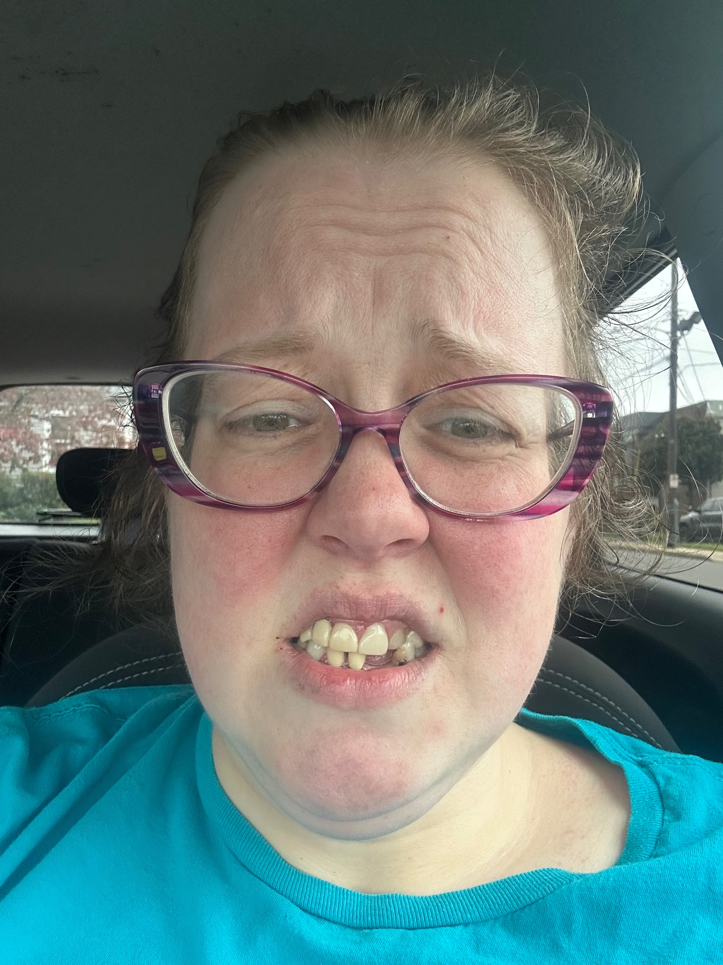 Donate to Preserve Remaining Teeth campaign photo, 2 of 6