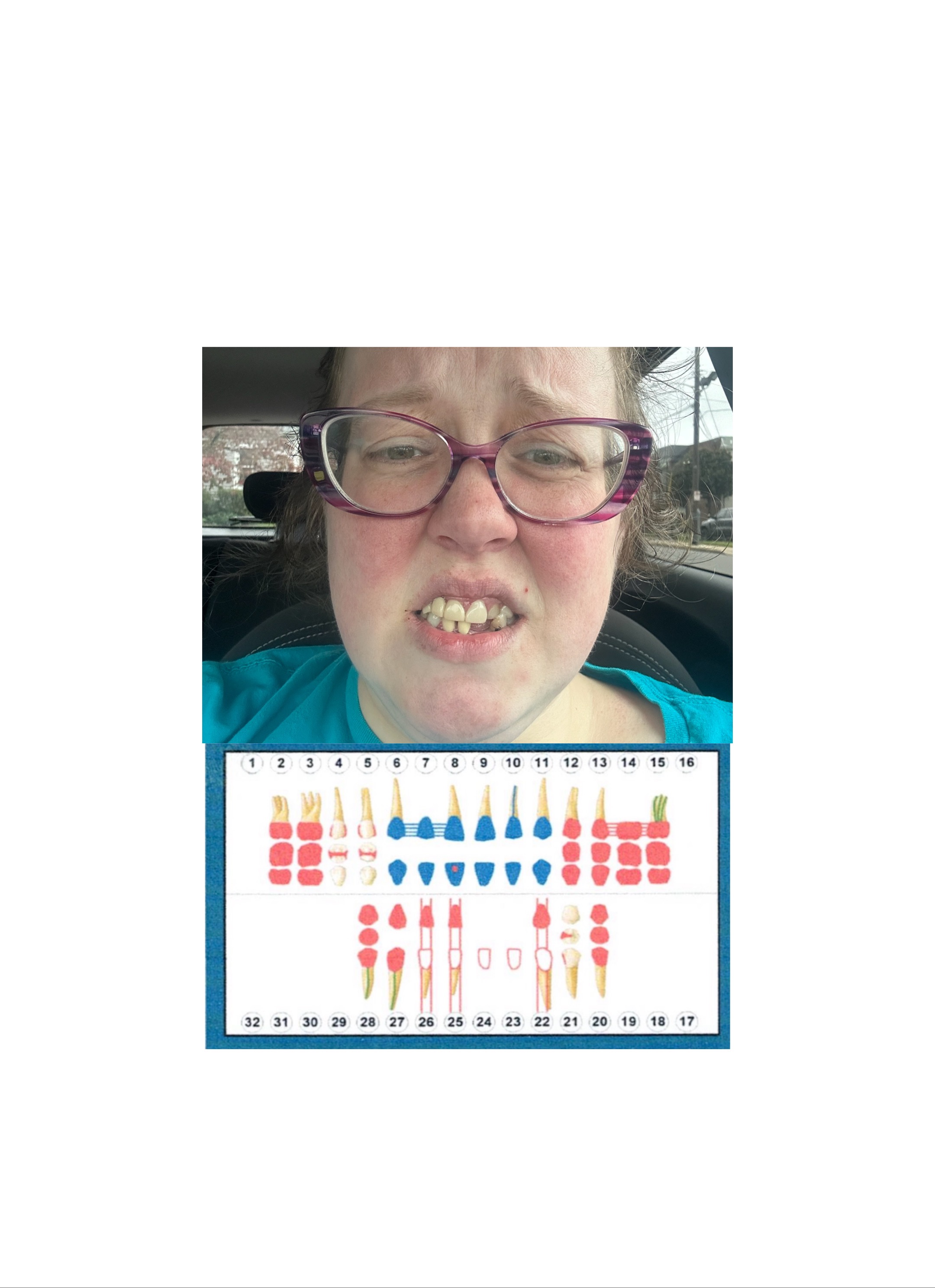 Donate to Preserve Remaining Teeth campaign photo, 4 of 6