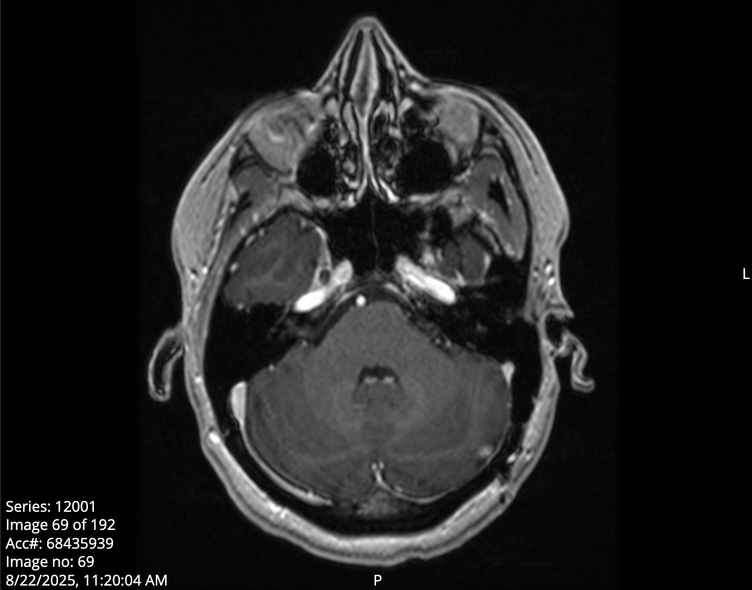 Assist in Easing Burden of Terminal Cancer for Alicia campaign photo, 6 of 7