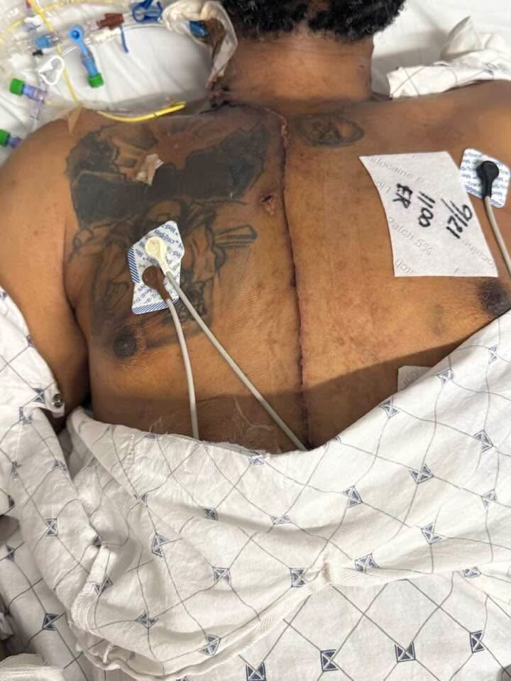 A Heart to  Help Rob Recover from Open-Heart Surgery campaign photo, 4 of 8