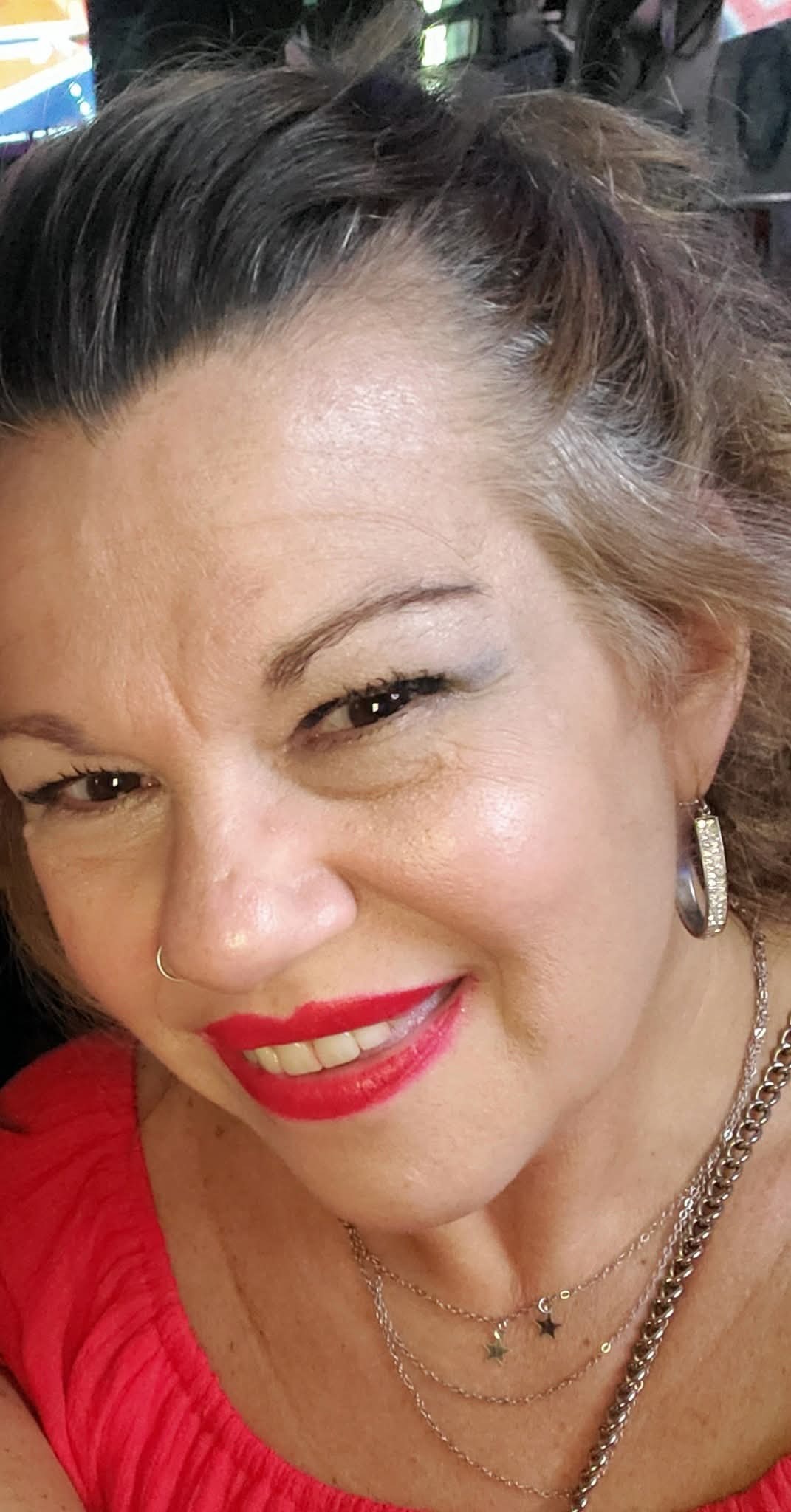 Support Cataract Surgery for My Bestie campaign photo, 5 of 6
