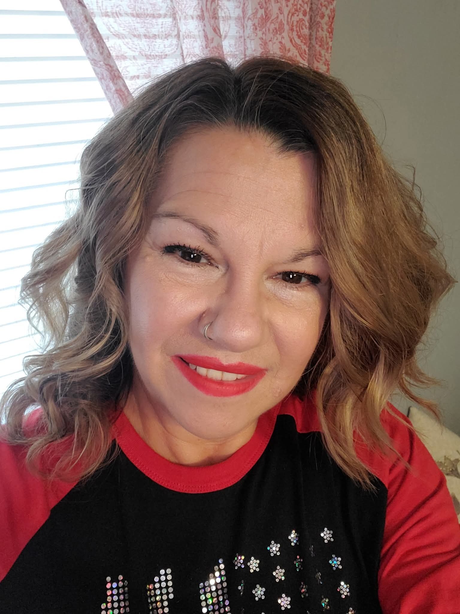 Support Cataract Surgery for My Bestie campaign photo, 2 of 6
