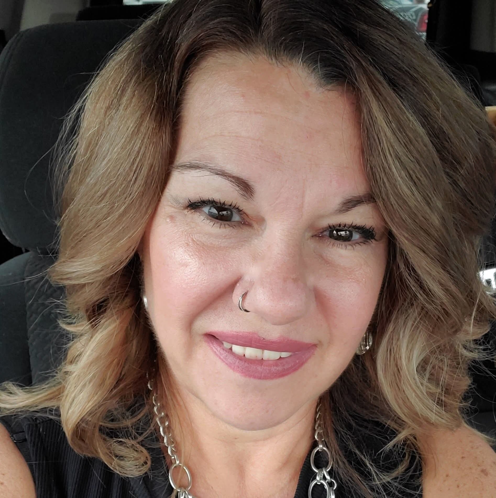 Support Cataract Surgery for My Bestie campaign photo, 4 of 6