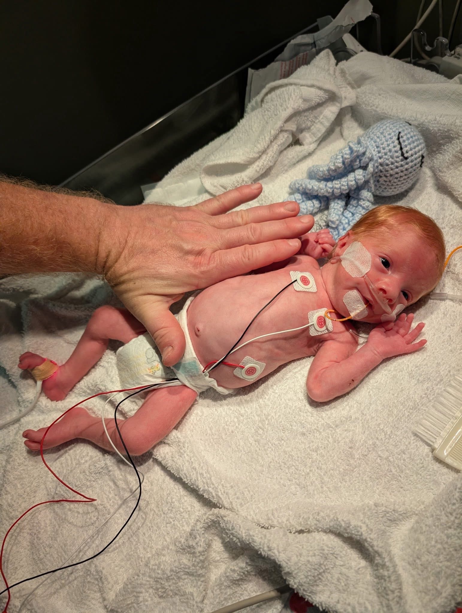 Support the Swann Family's NICU Journey campaign photo, 2 of 7