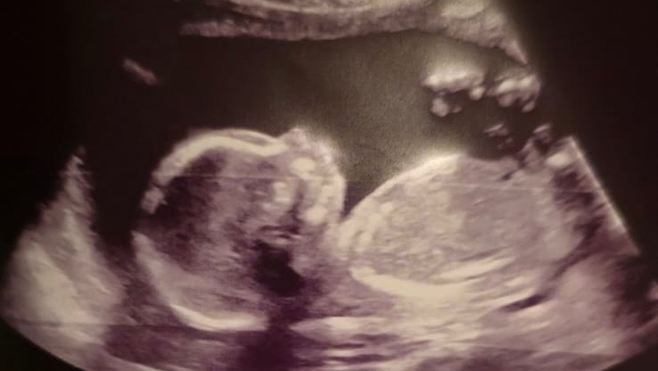 Donate to Help a Young Family Get Back on Their Feet, organized by Jonina Witherspoon