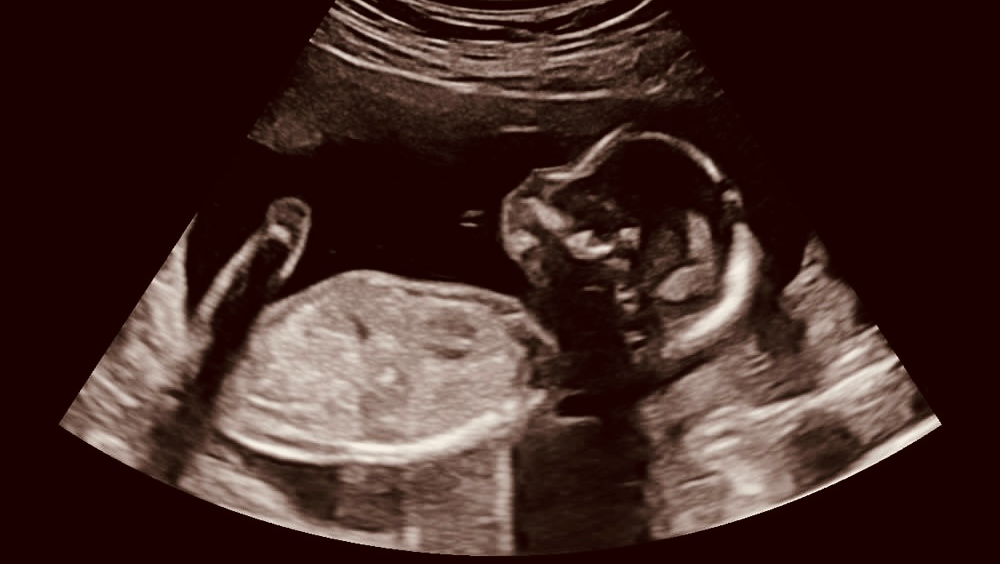 Trying to Get Back on My Feet Before Baby Arrives ❤️ photo