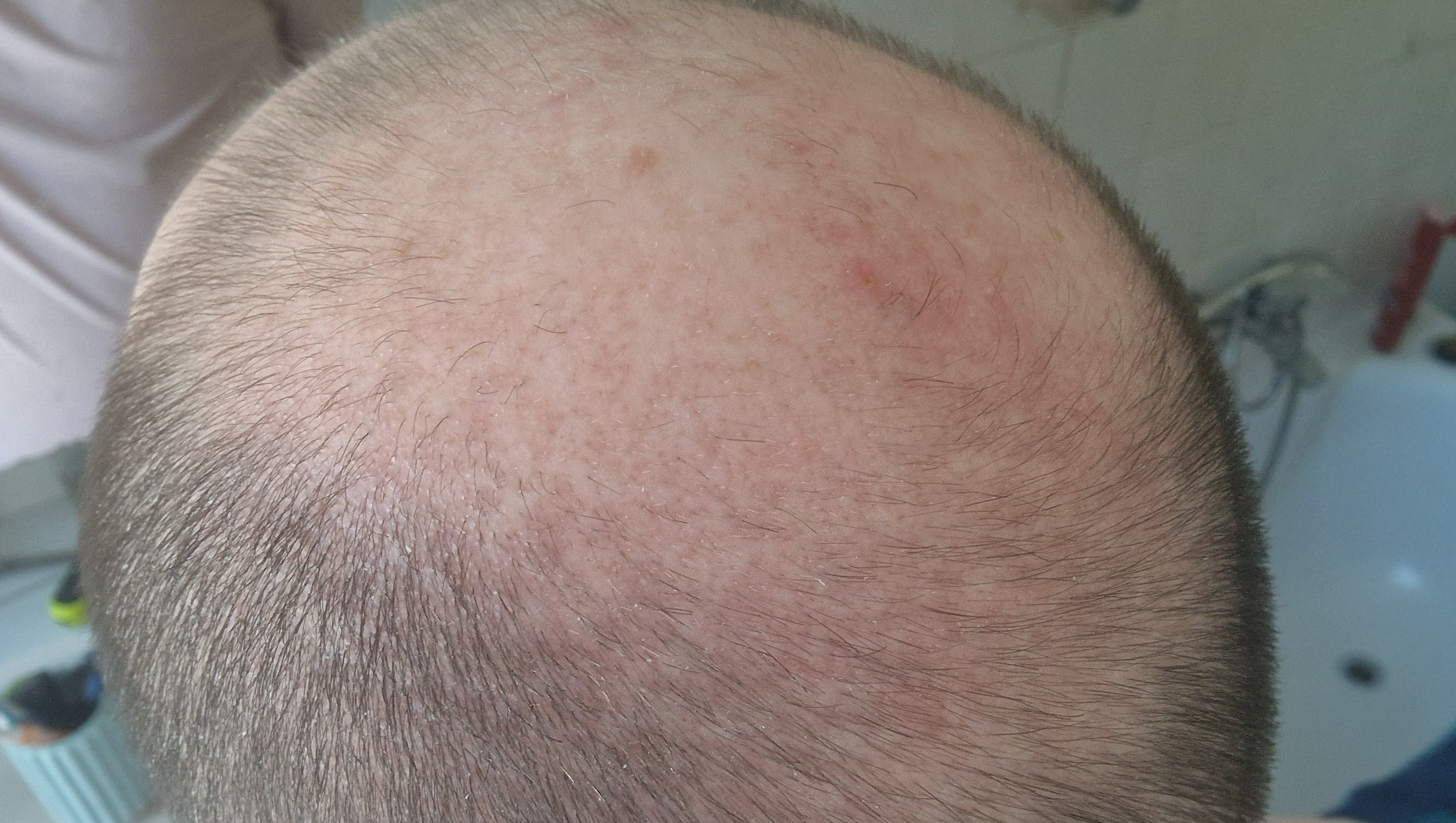 Kevin needs your support , it will mean everything to him photo