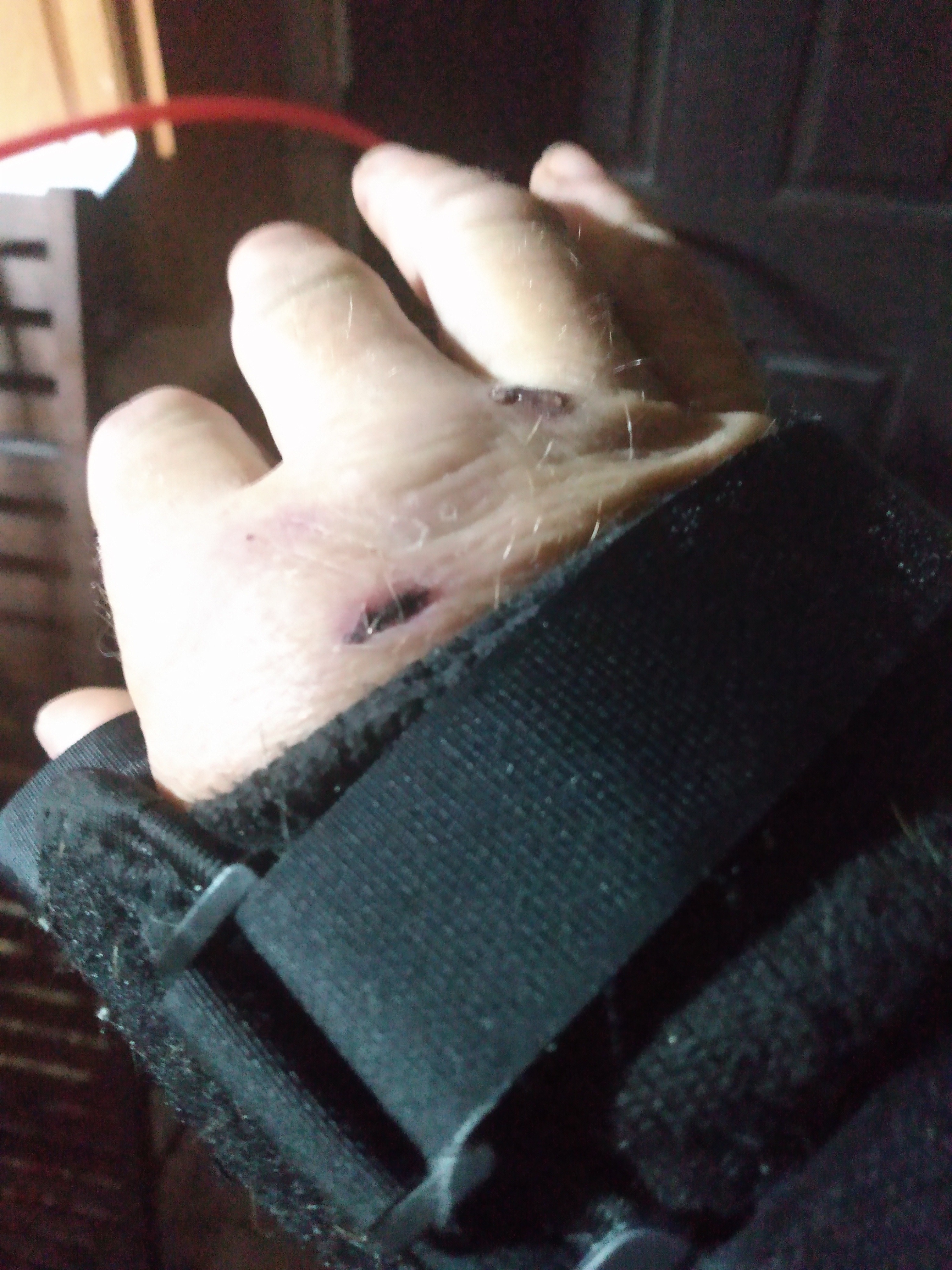 Ohio Biker Survives 60MPH Deer Smash Help Cover Medical Bi campaign photo, 7 of 8