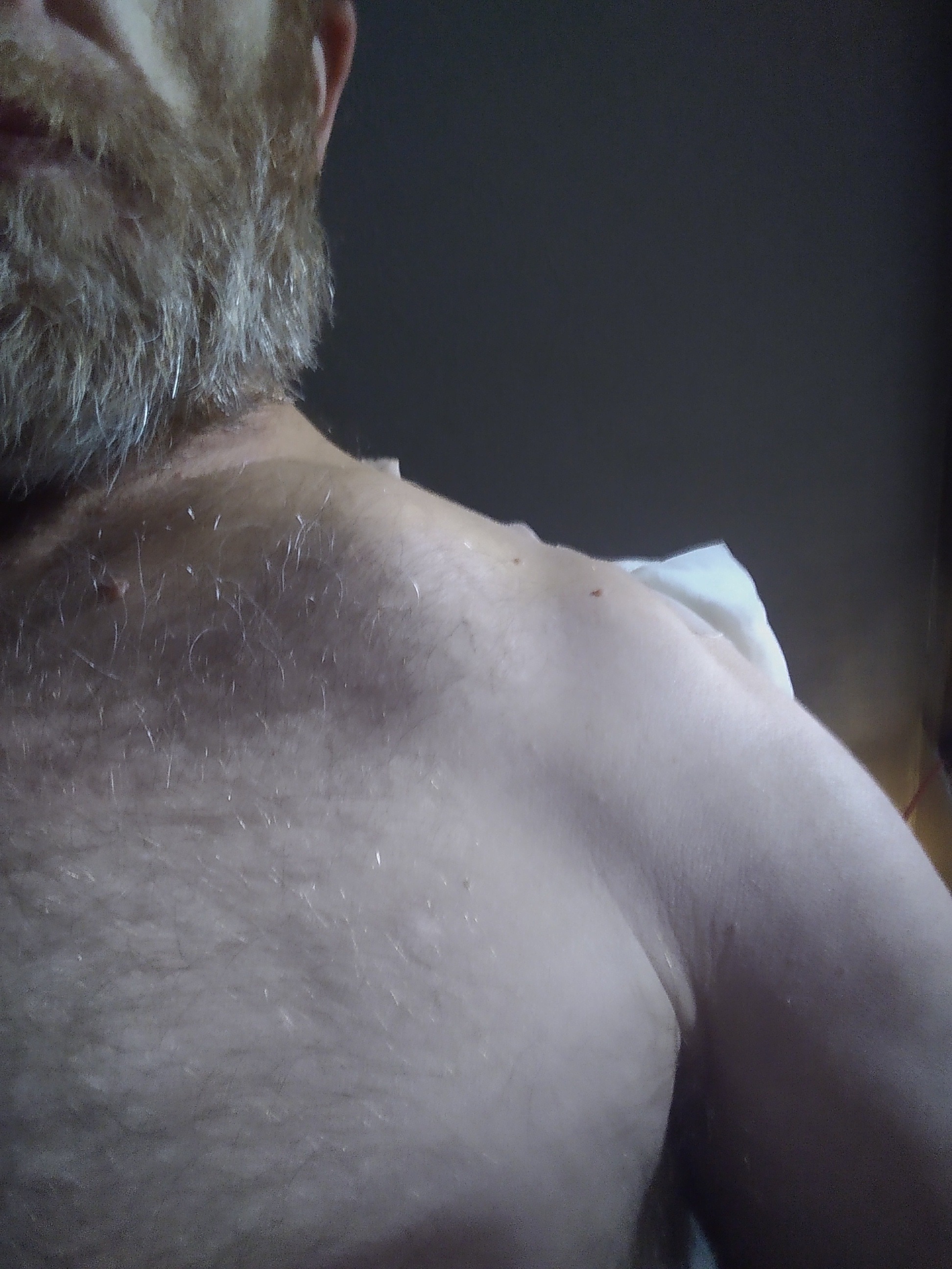 Ohio Biker Survives 60MPH Deer Smash Help Cover Medical Bi campaign photo, 5 of 8