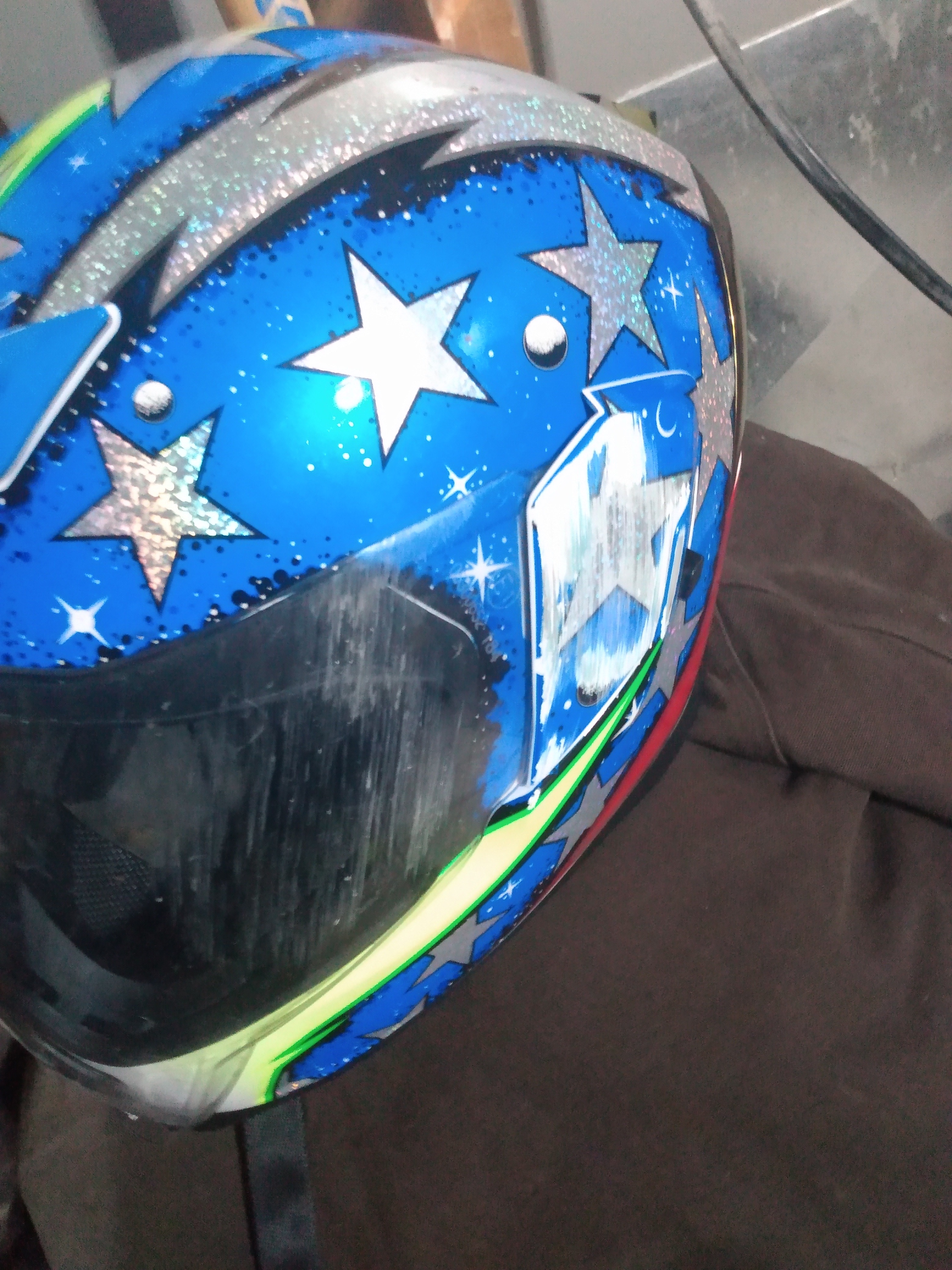Ohio Biker Survives 60MPH Deer Smash Help Cover Medical Bi campaign photo, 6 of 8