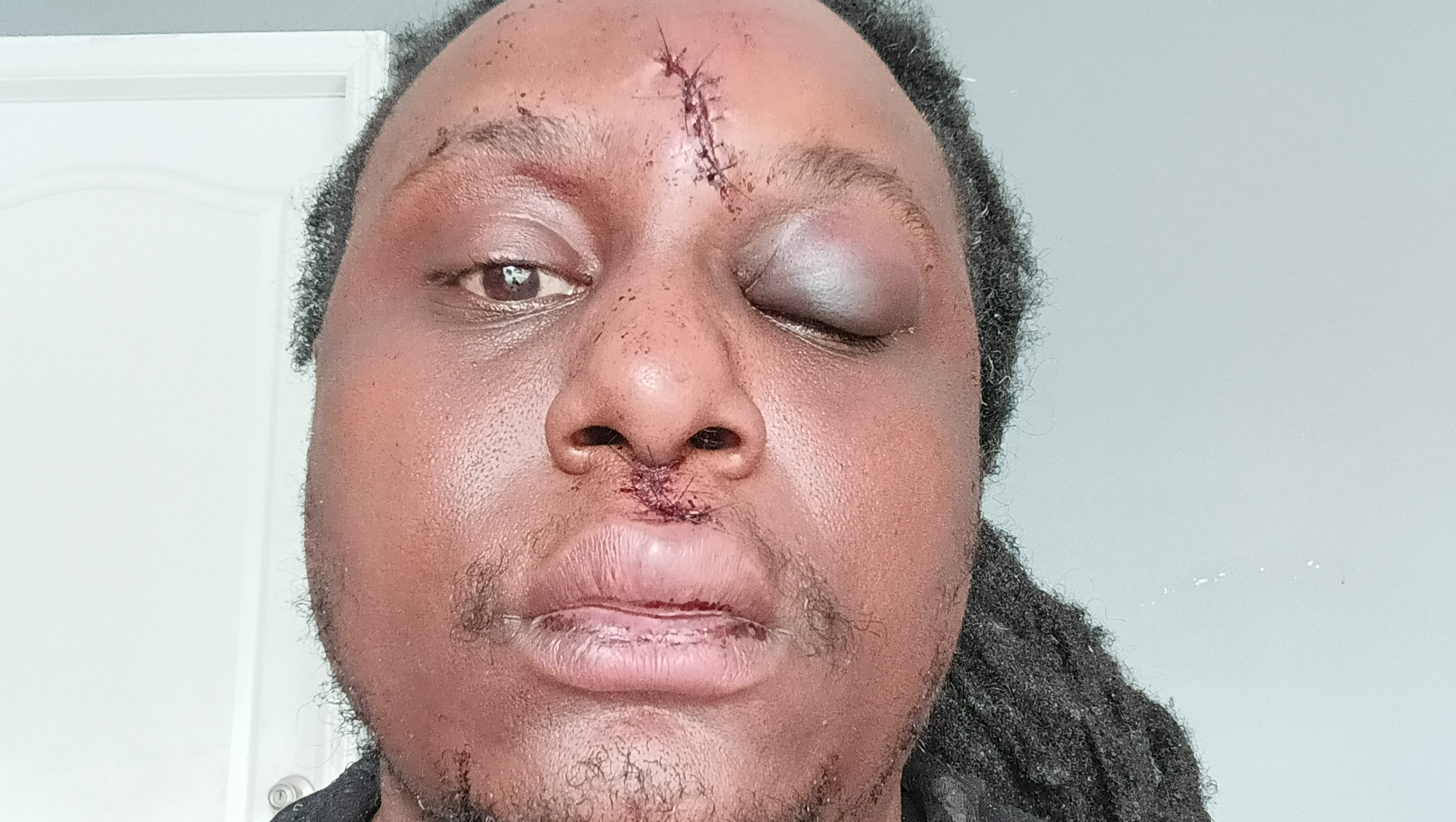 Support Ybor crash efforts Myron Walker's Medical Journey photo
