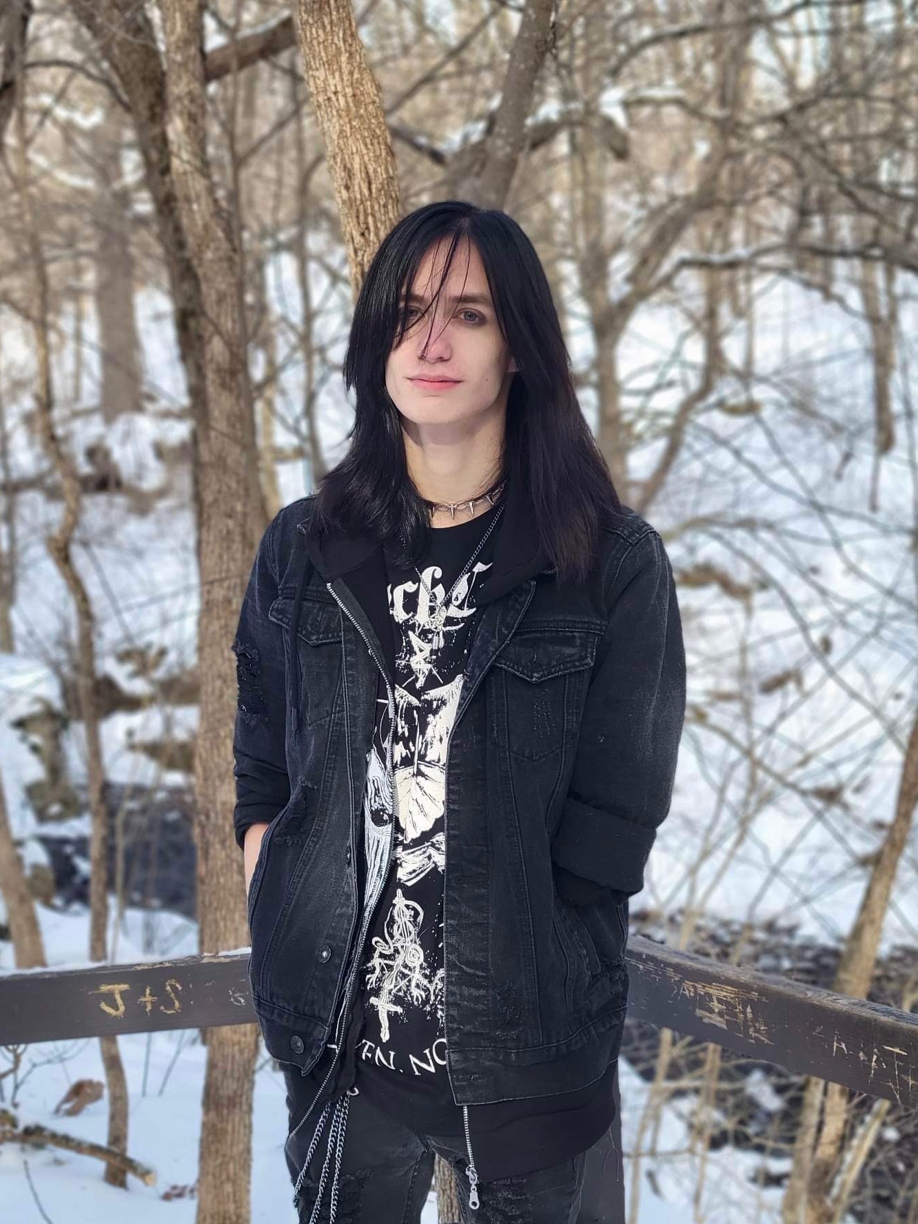 Donate to Tyeus' Myoelectric Prosthetic Fund campaign photo, 2 of 7