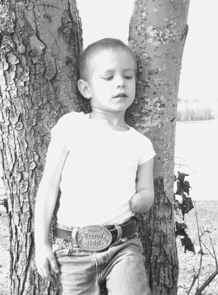 Donate to Tyeus' Myoelectric Prosthetic Fund campaign photo, 5 of 7