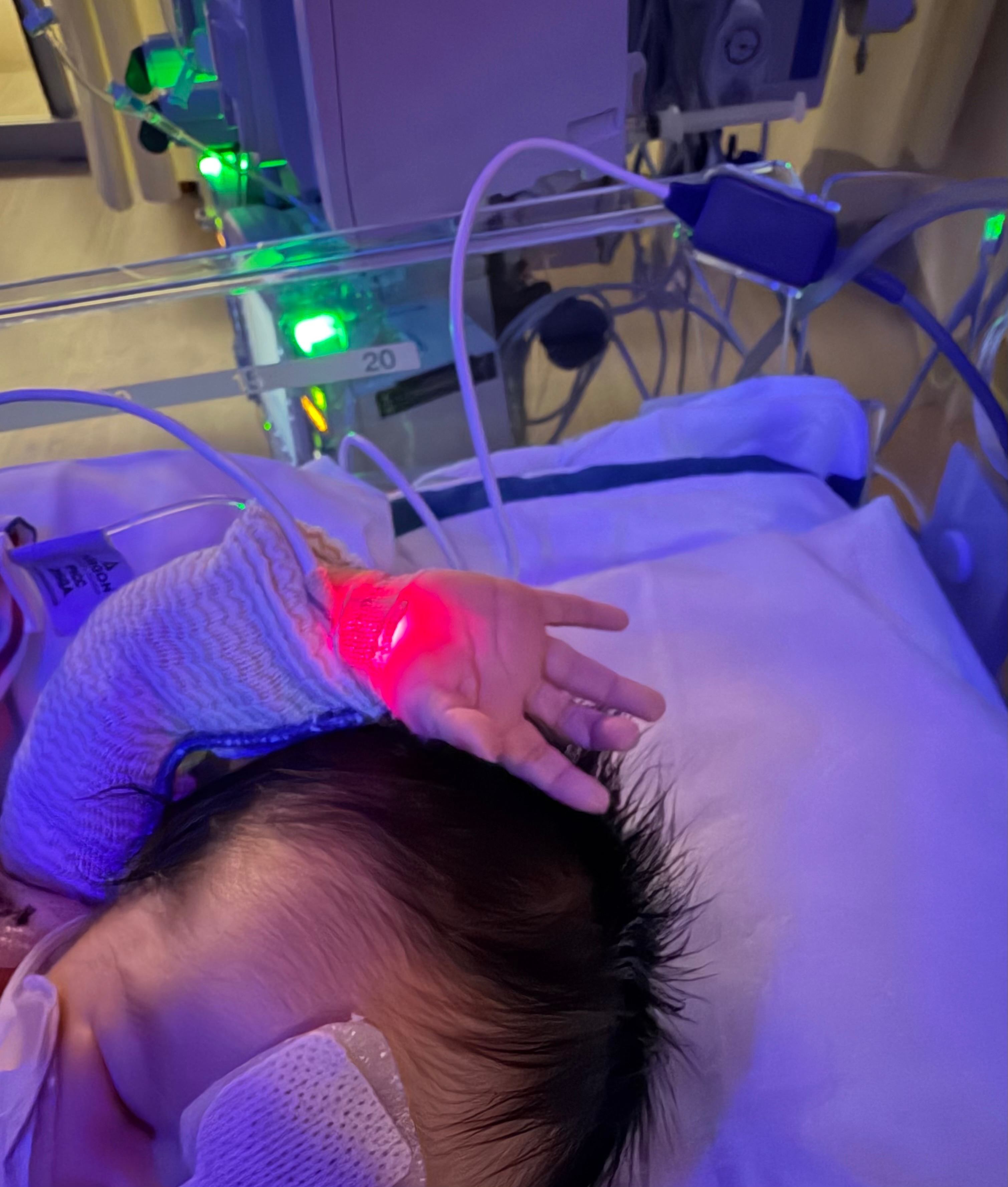 Donate to Baby Sophia's Heart Surgery Journey campaign photo, 4 of 6
