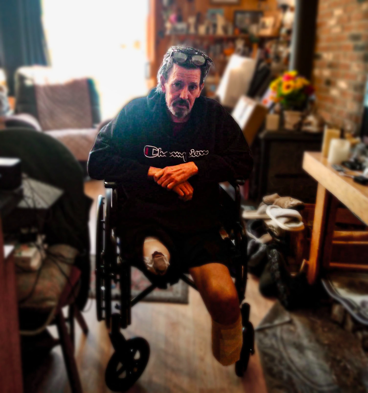 Help Eric recover after a life-changing double amputation campaign photo, 2 of 4